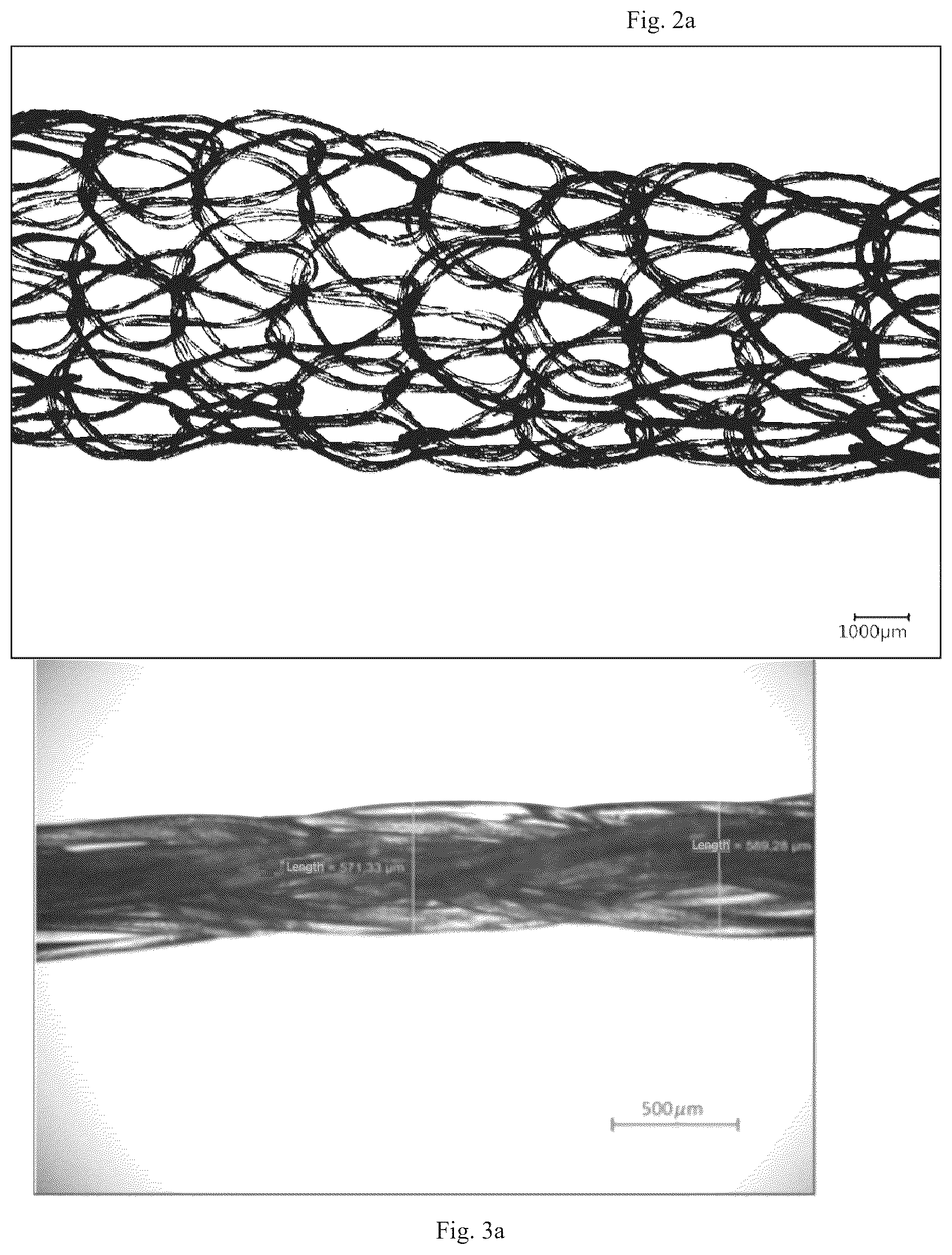 Patent US12576104 Figure 3 – Dental preparation comprising fibers based on hyaluronic acid with regulated biodegradability