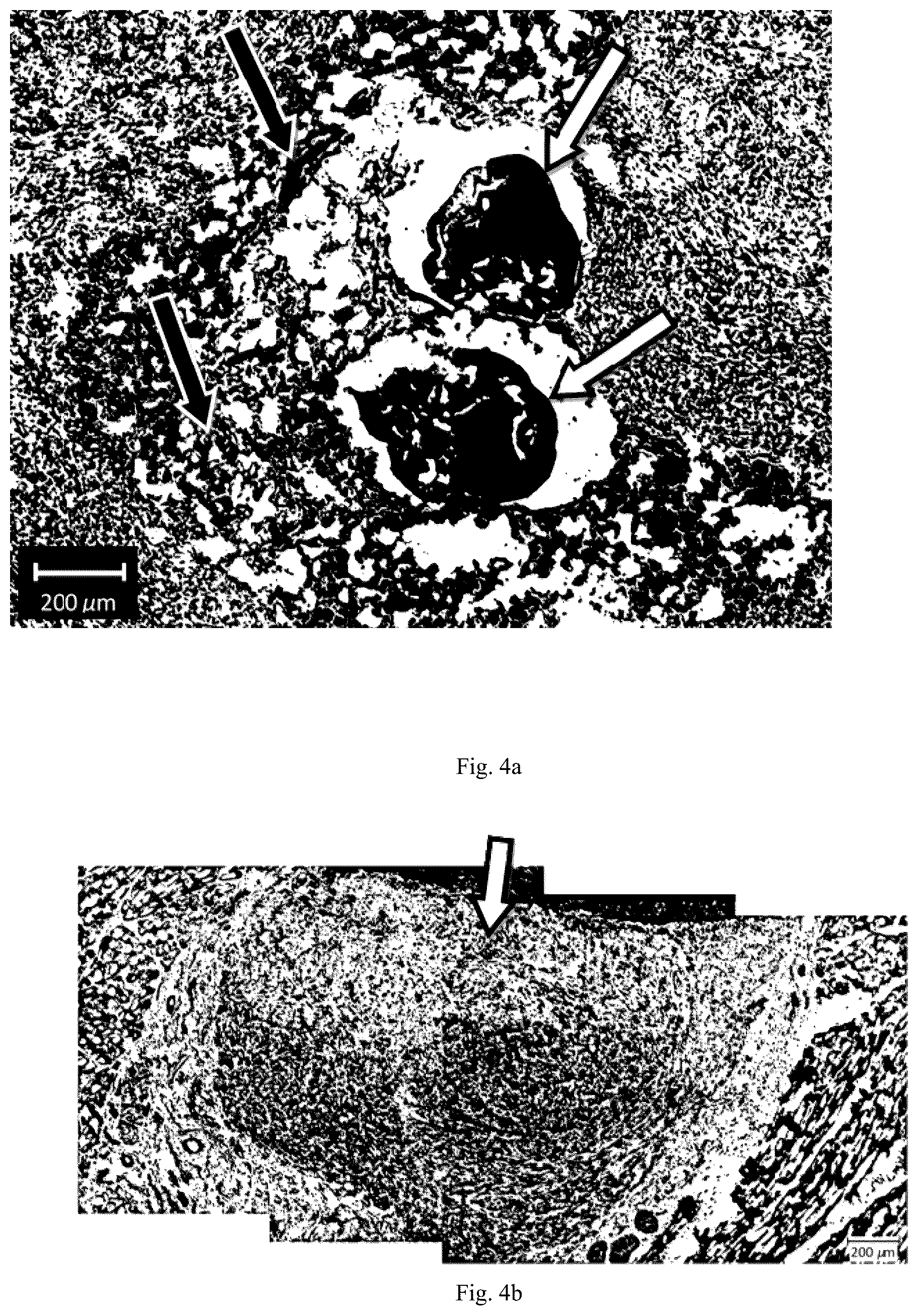 Patent US12576104 Figure 5 – Dental preparation comprising fibers based on hyaluronic acid with regulated biodegradability