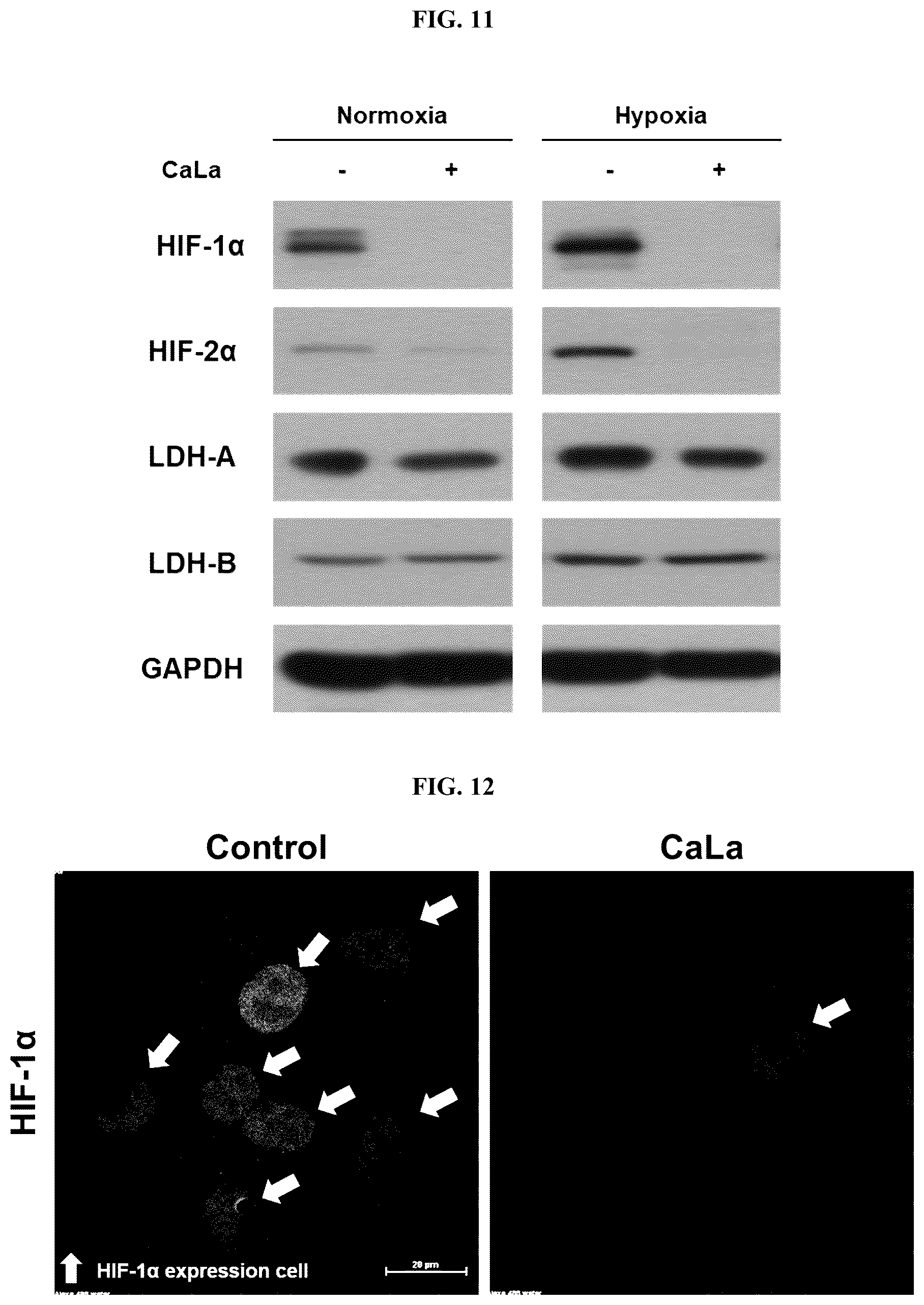 Patent US12576107 Figure 6 – Methods of treating chronic inflammatory diseases