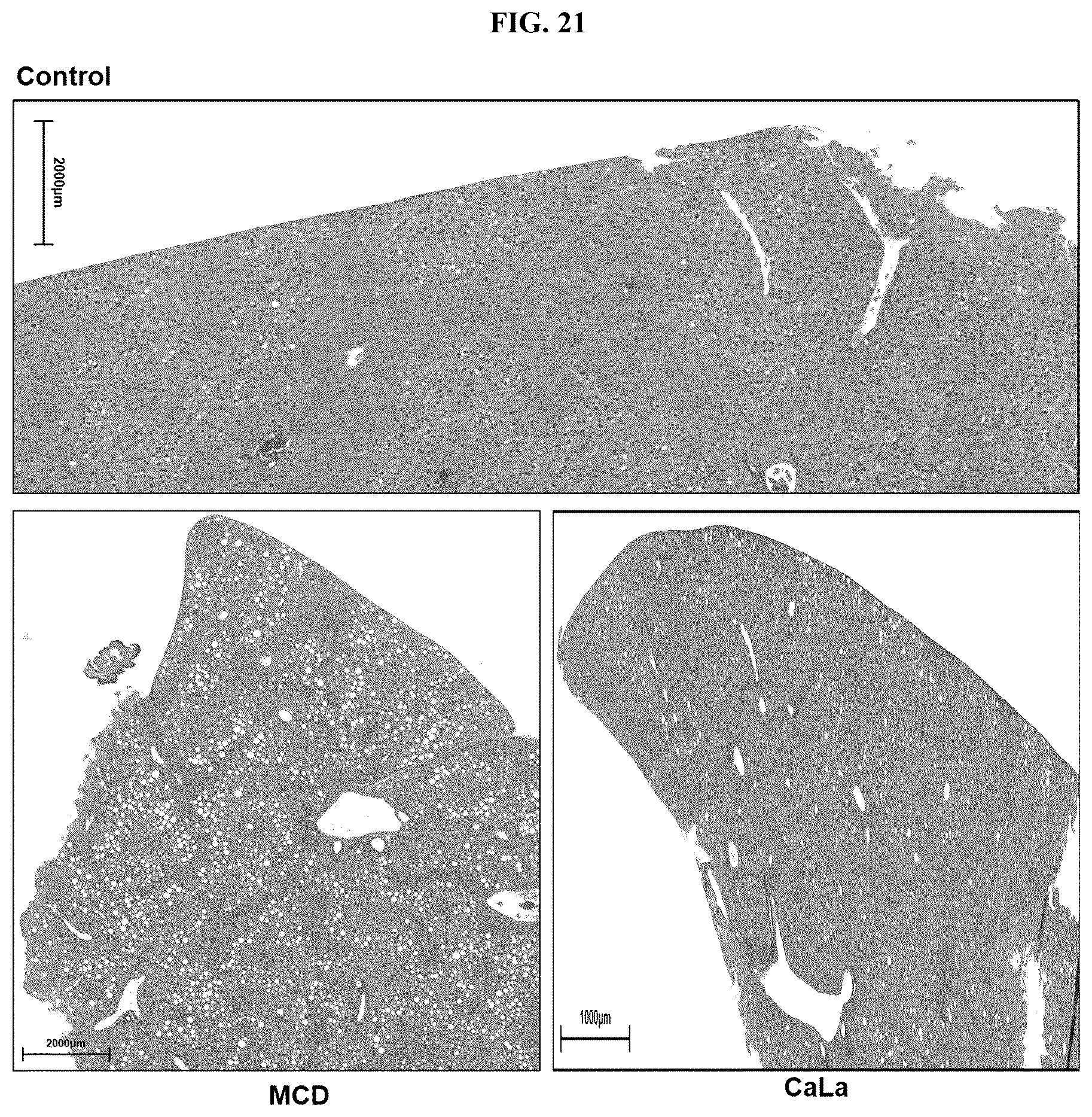 Patent US12576107 Figure 11 – Methods of treating chronic inflammatory diseases