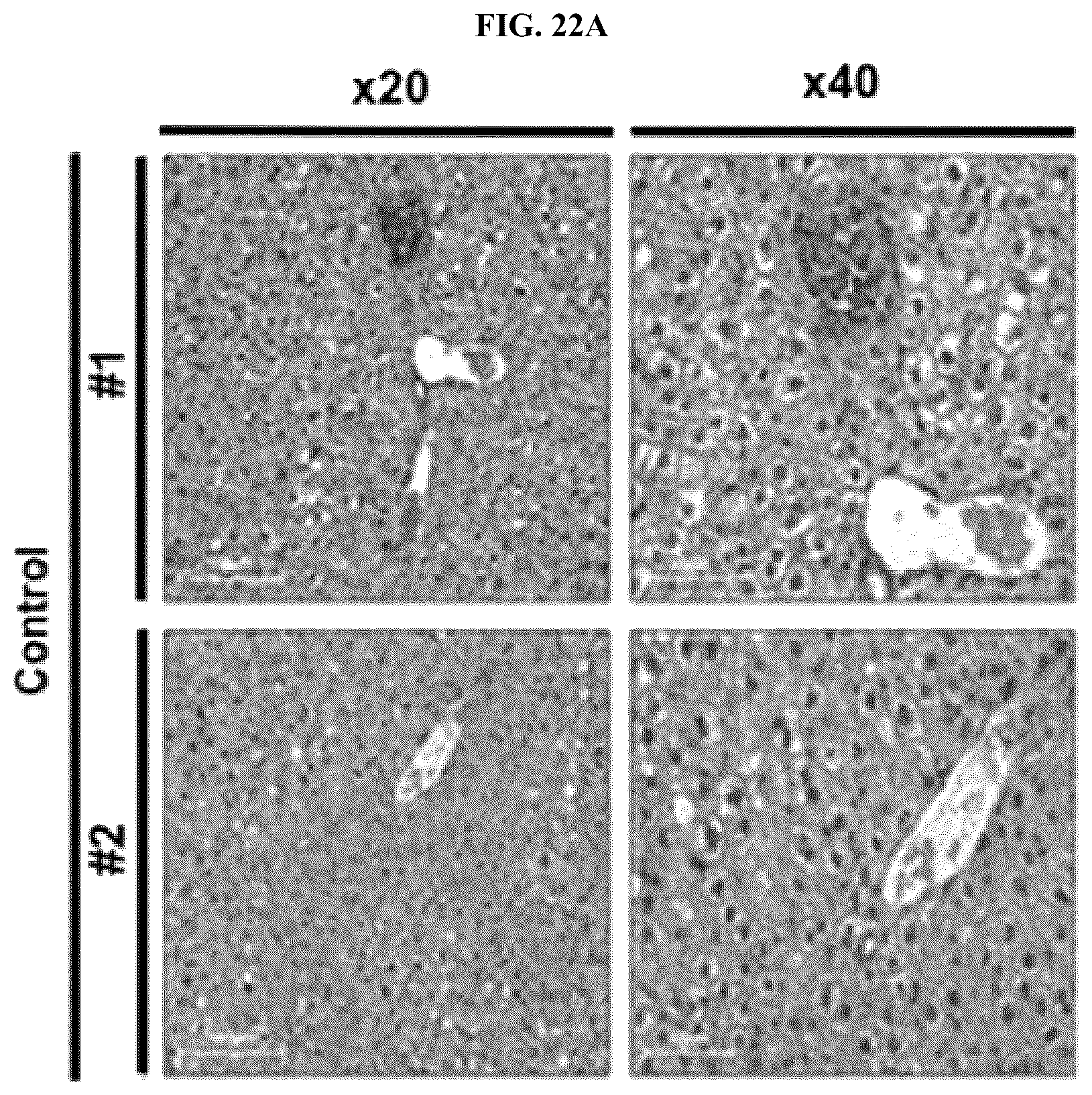 Patent US12576107 Figure 12 – Methods of treating chronic inflammatory diseases