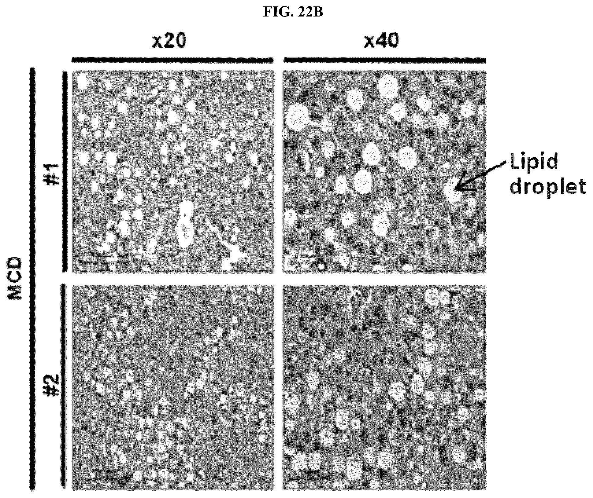 Patent US12576107 Figure 13 – Methods of treating chronic inflammatory diseases