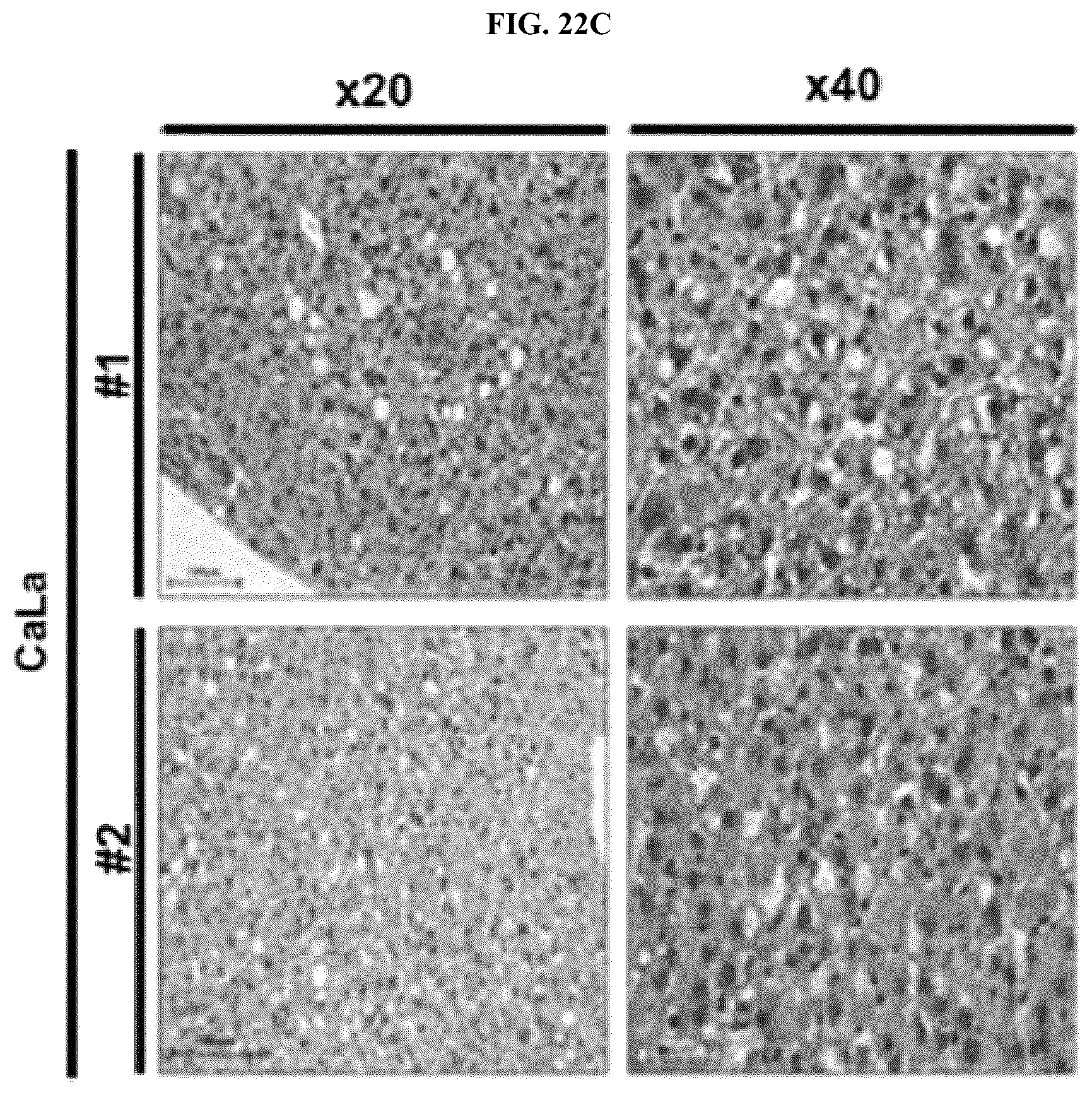 Patent US12576107 Figure 14 – Methods of treating chronic inflammatory diseases