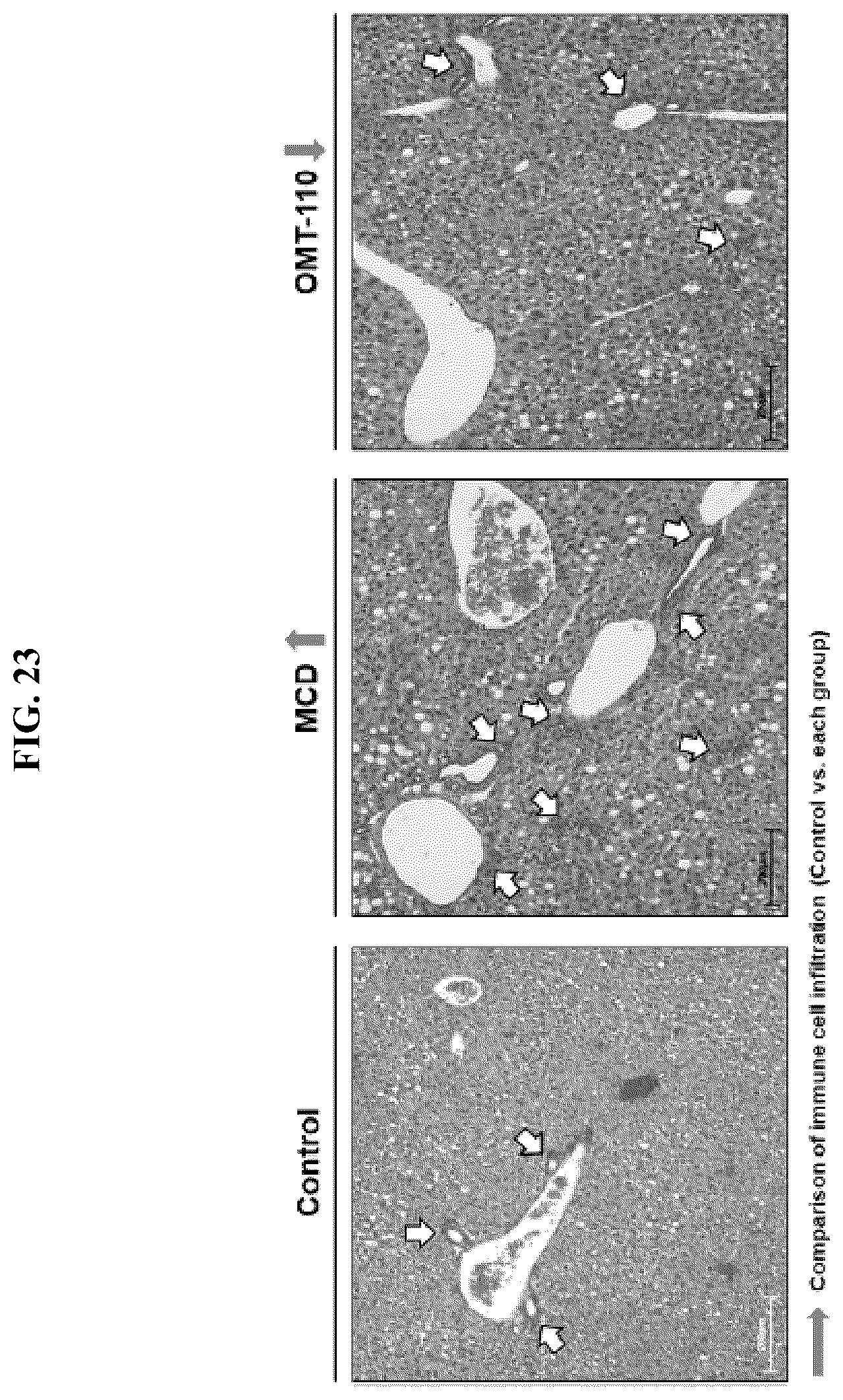 Patent US12576107 Figure 15 – Methods of treating chronic inflammatory diseases