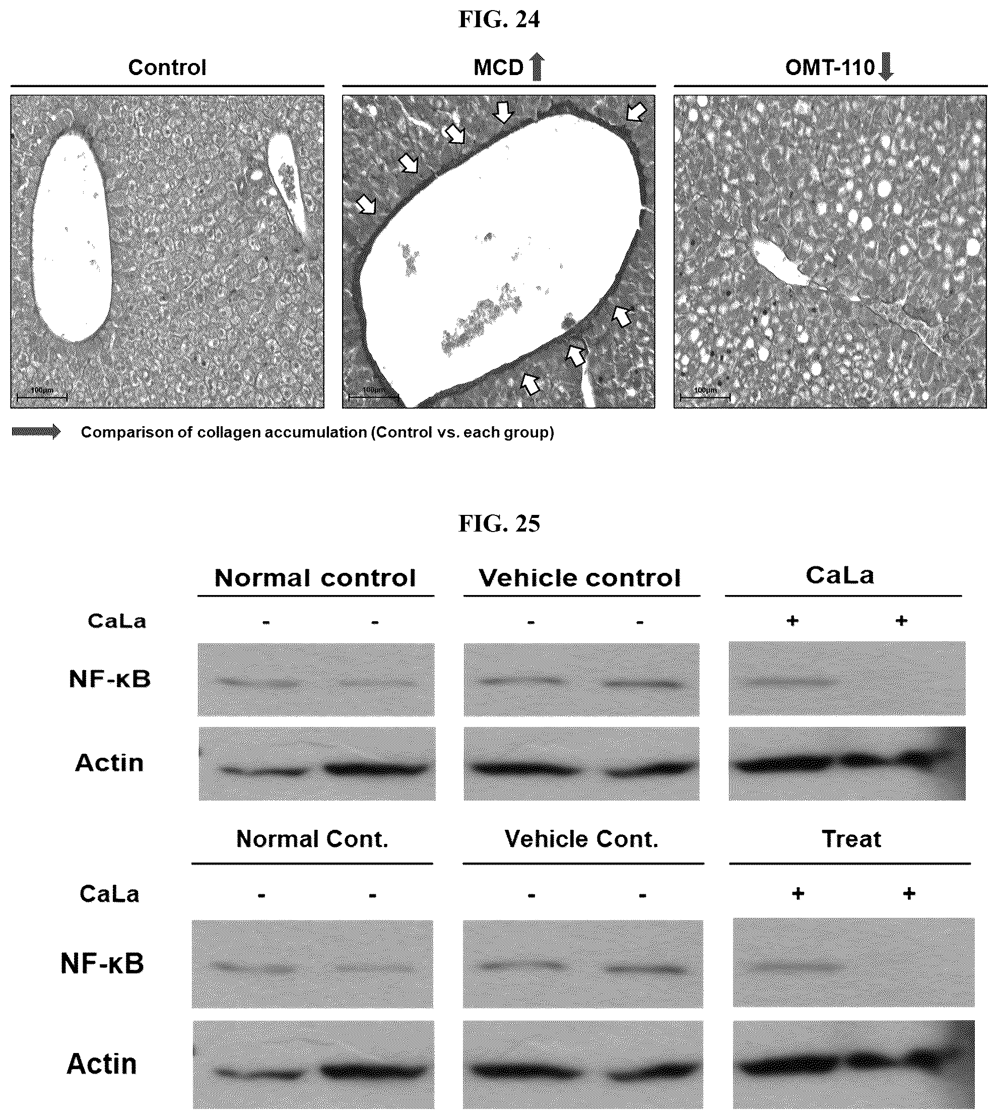 Patent US12576107 Figure 16 – Methods of treating chronic inflammatory diseases