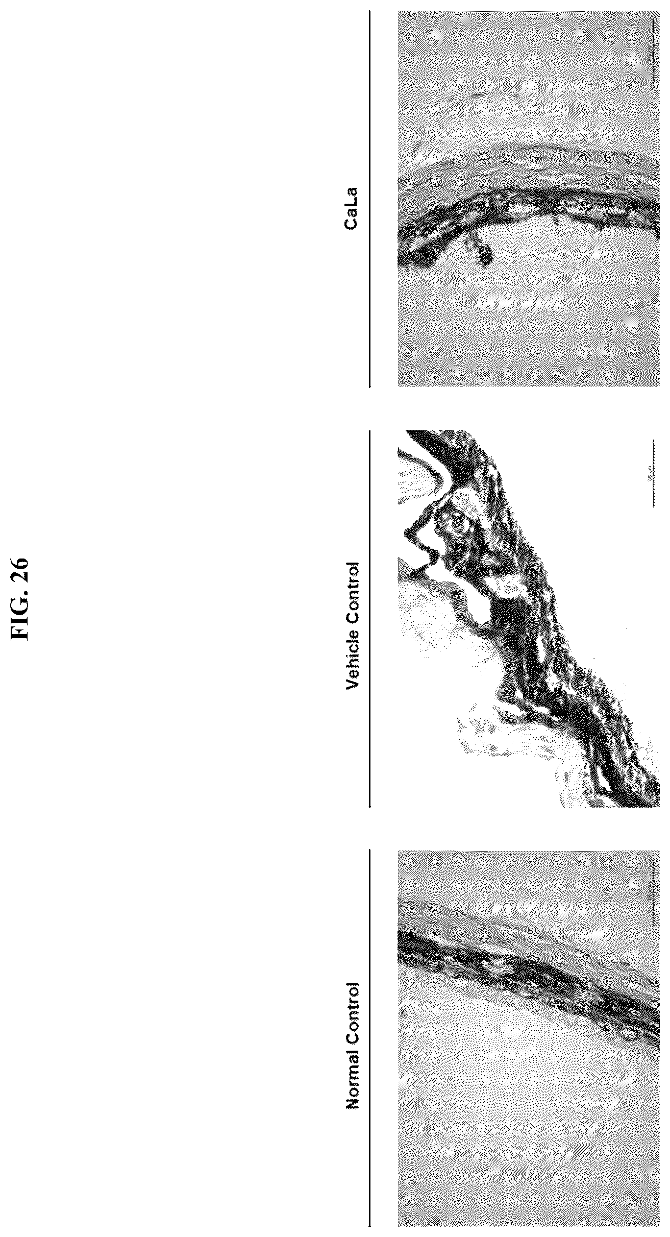 Patent US12576107 Figure 17 – Methods of treating chronic inflammatory diseases