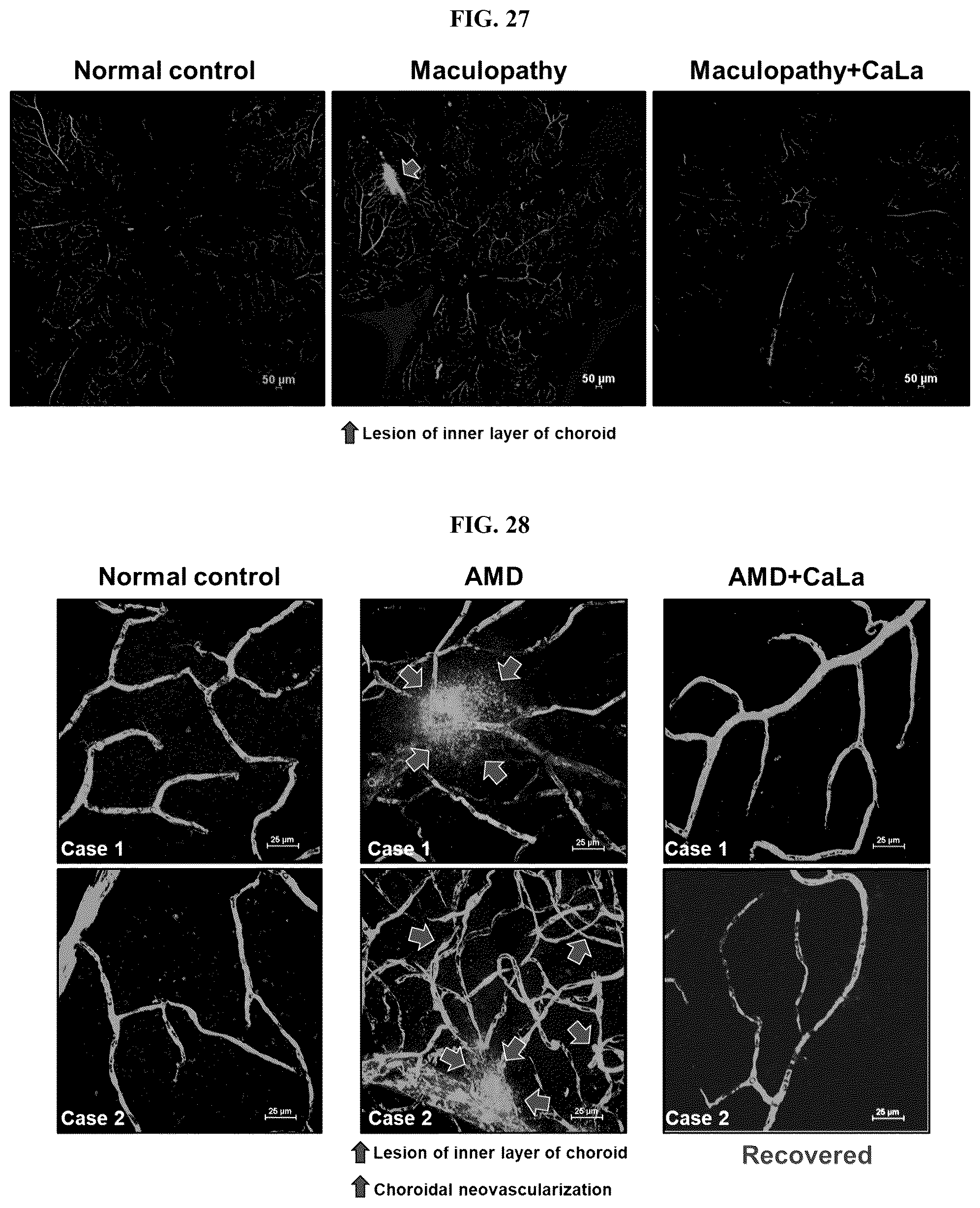 Patent US12576107 Figure 18 – Methods of treating chronic inflammatory diseases