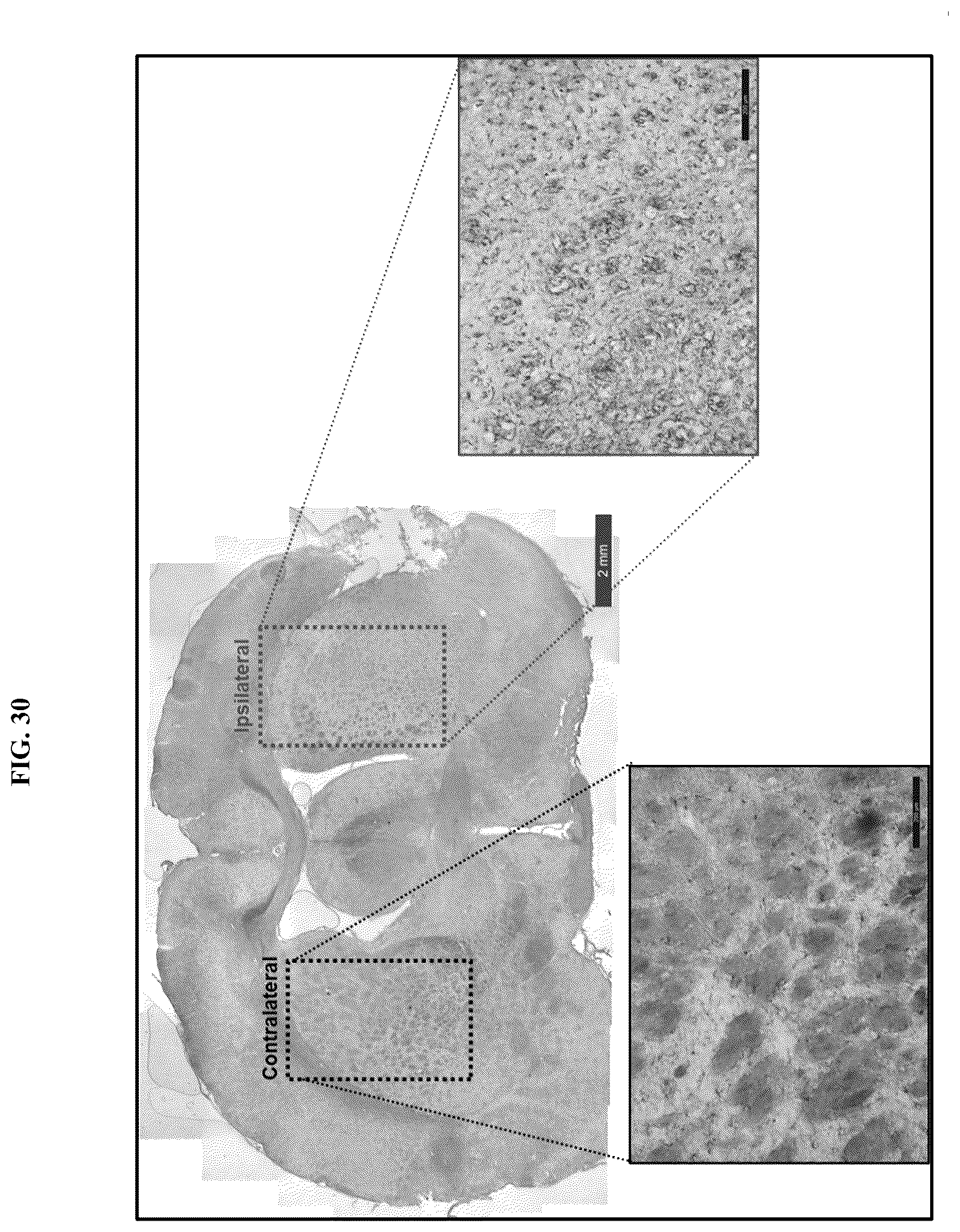 Patent US12576107 Figure 20 – Methods of treating chronic inflammatory diseases