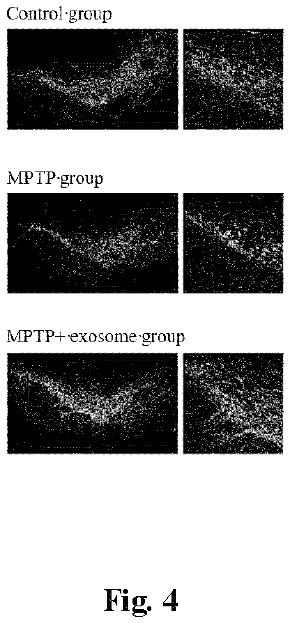 Patent US12576111 Figure 5 – Application of BMSC-exos in treating PD
