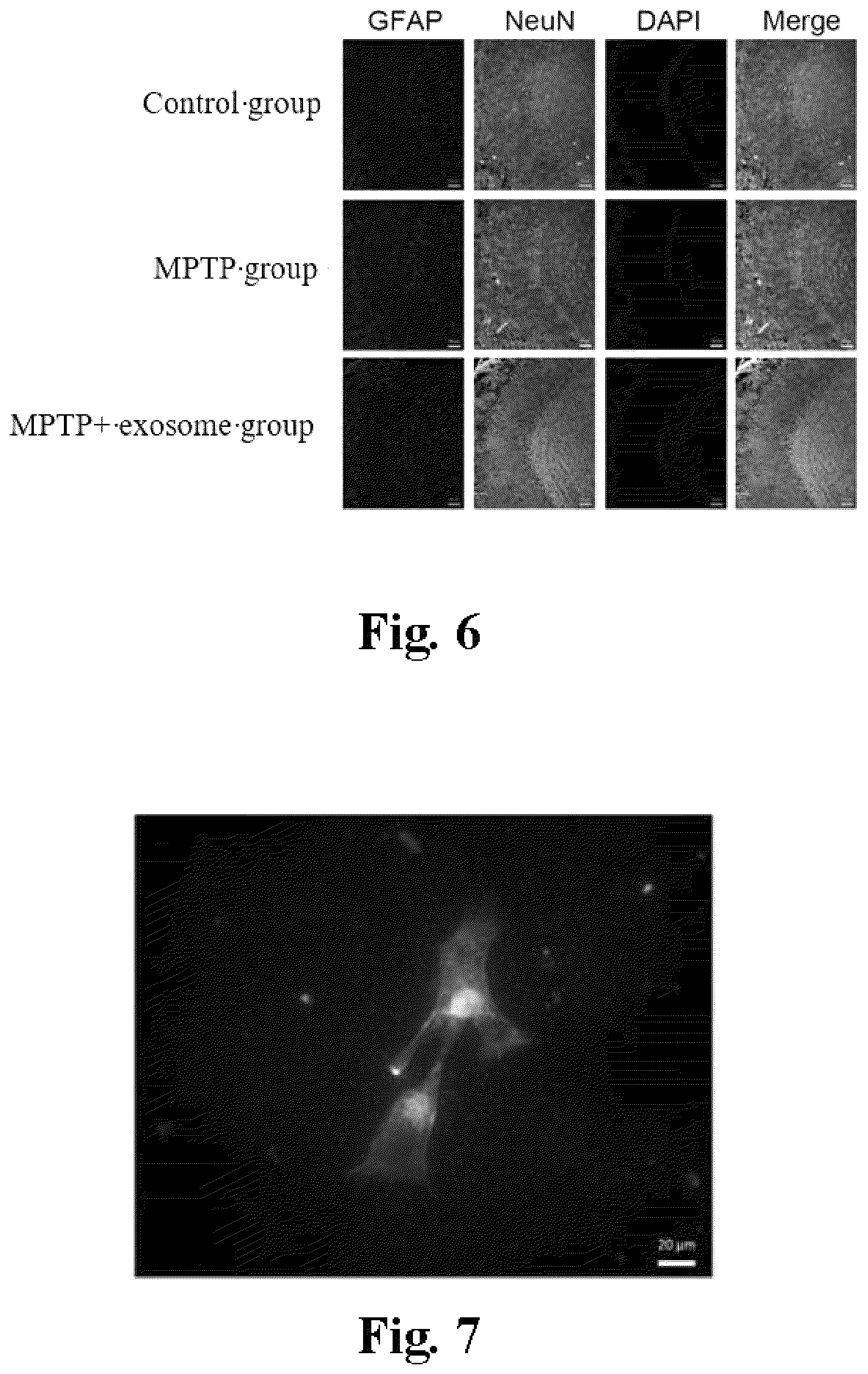Patent US12576111 Figure 7 – Application of BMSC-exos in treating PD