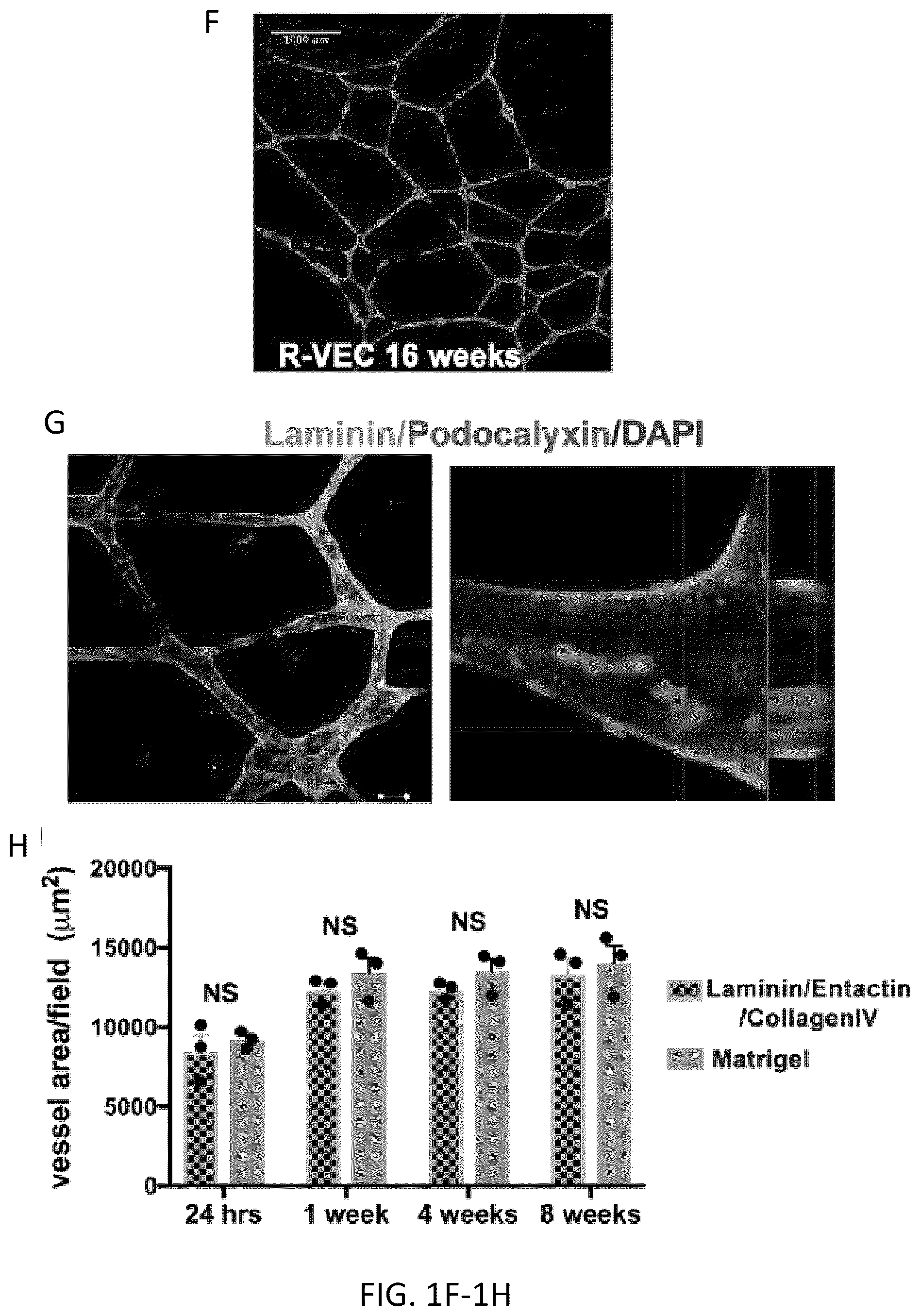 Patent US12576114 Figure 3 – Methods of functional vascularization of pancreatic islets and beta-cell organoids
