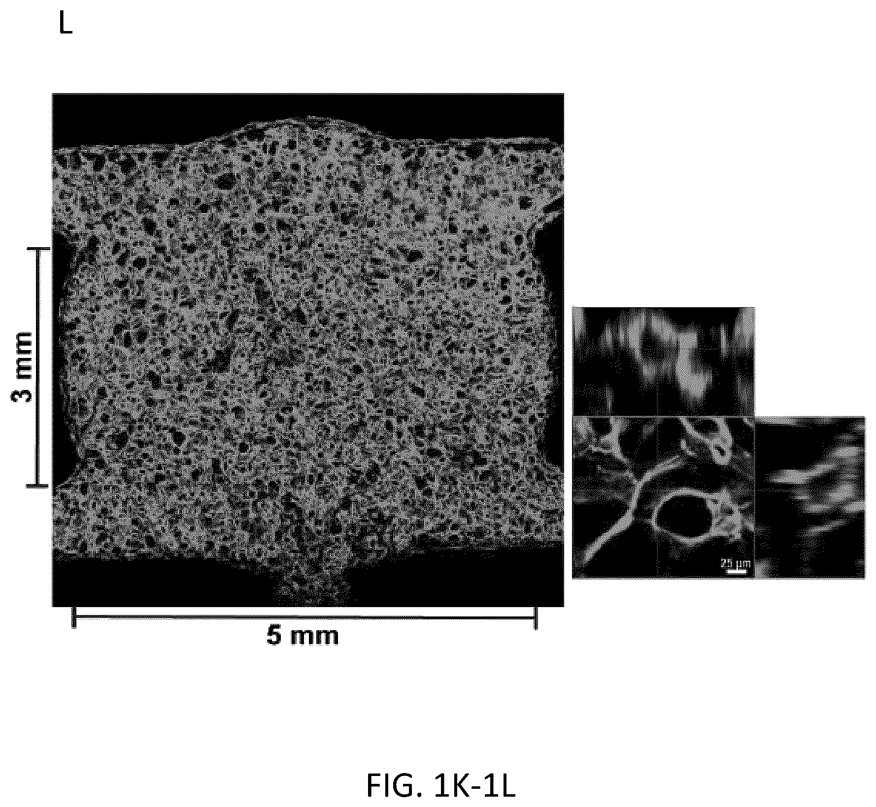 Patent US12576114 Figure 6 – Methods of functional vascularization of pancreatic islets and beta-cell organoids