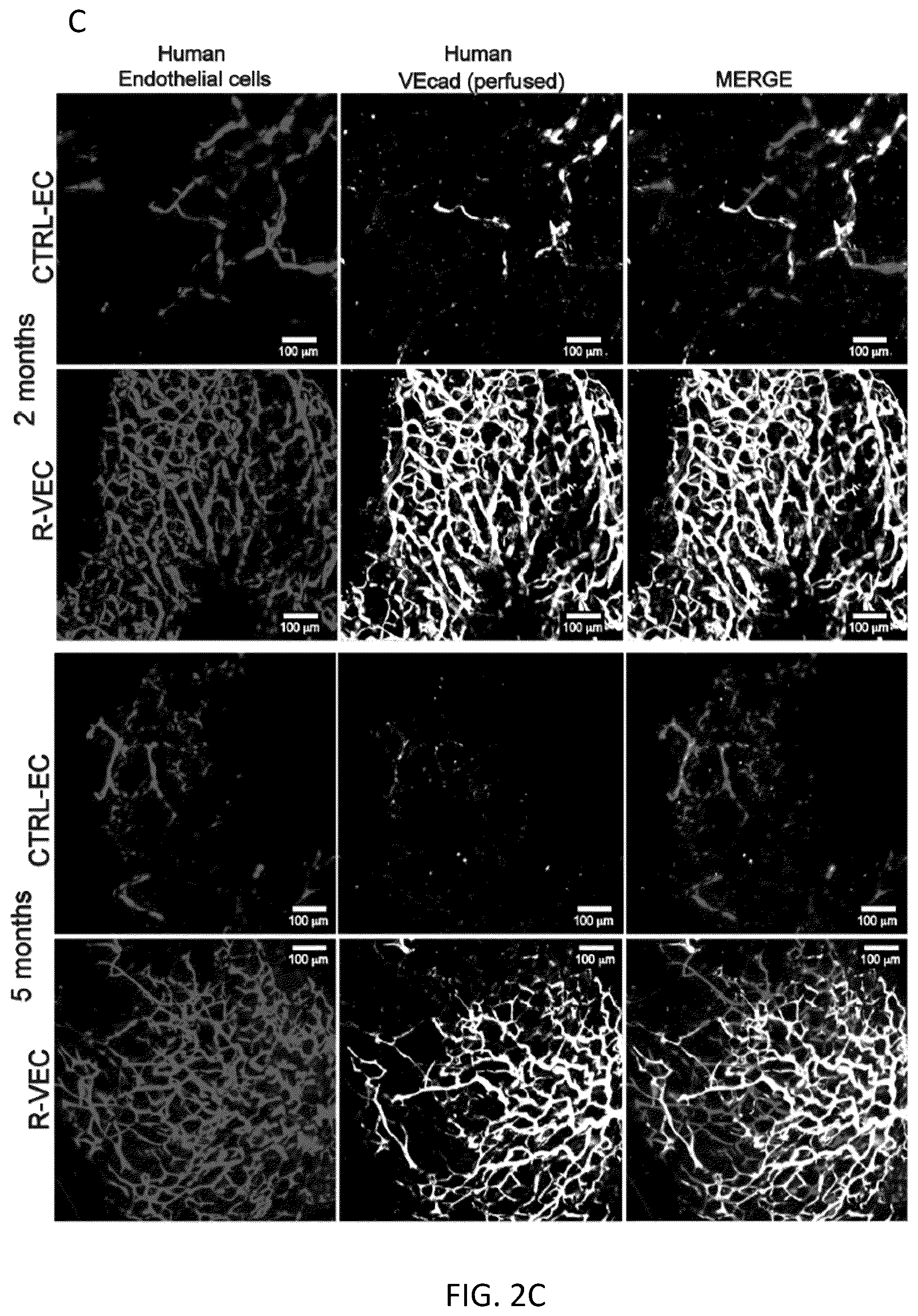Patent US12576114 Figure 9 – Methods of functional vascularization of pancreatic islets and beta-cell organoids