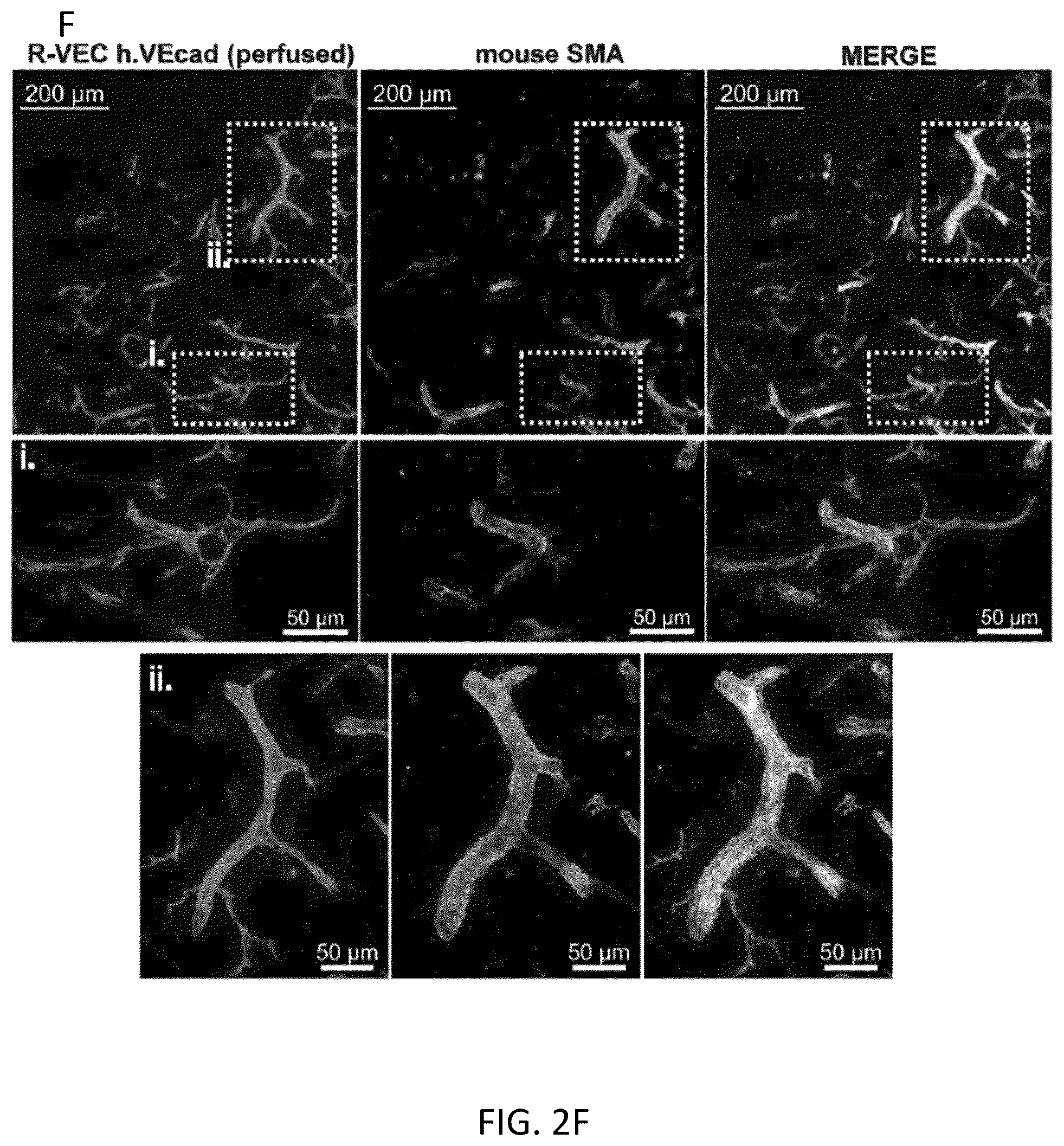 Patent US12576114 Figure 11 – Methods of functional vascularization of pancreatic islets and beta-cell organoids
