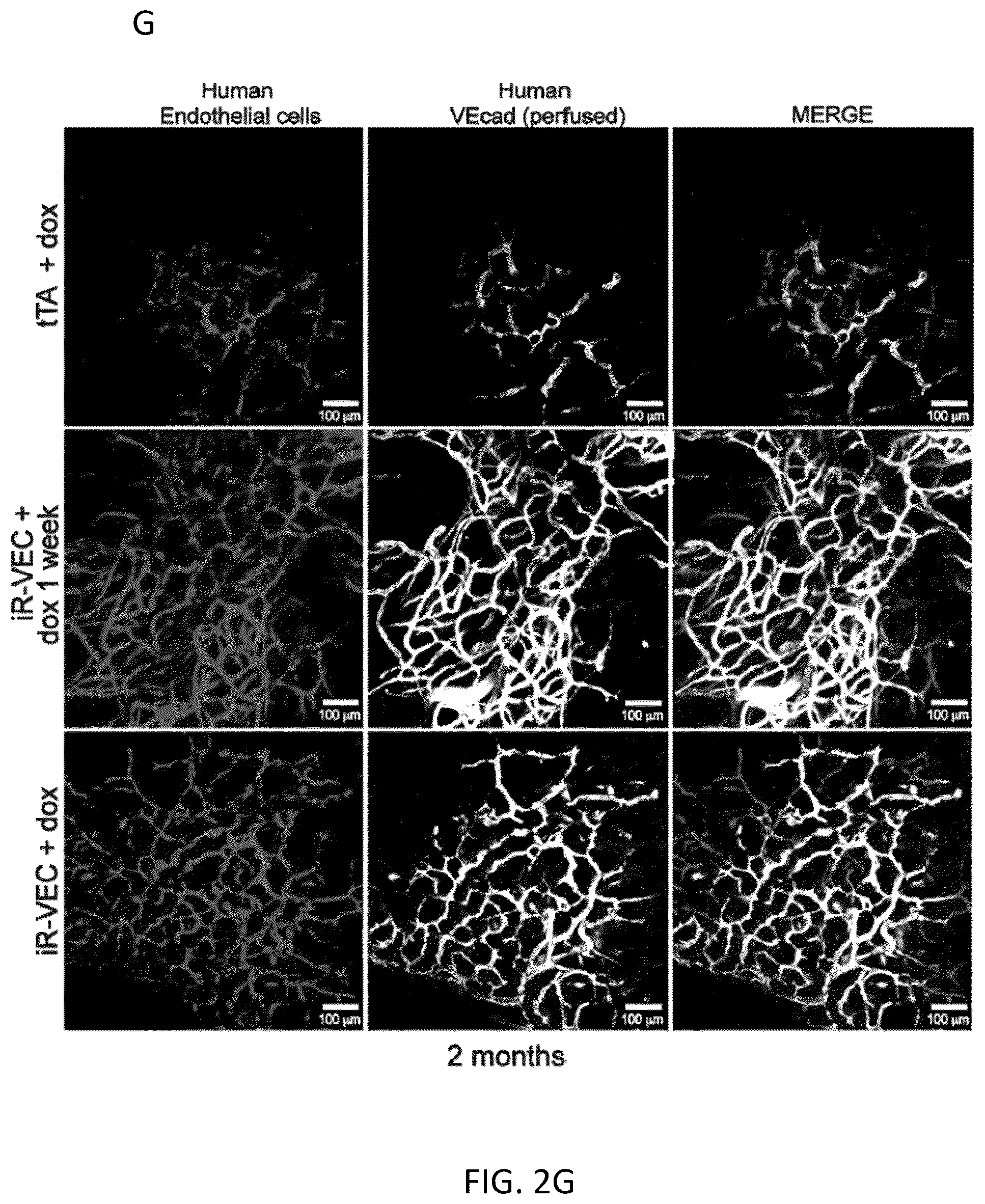 Patent US12576114 Figure 12 – Methods of functional vascularization of pancreatic islets and beta-cell organoids