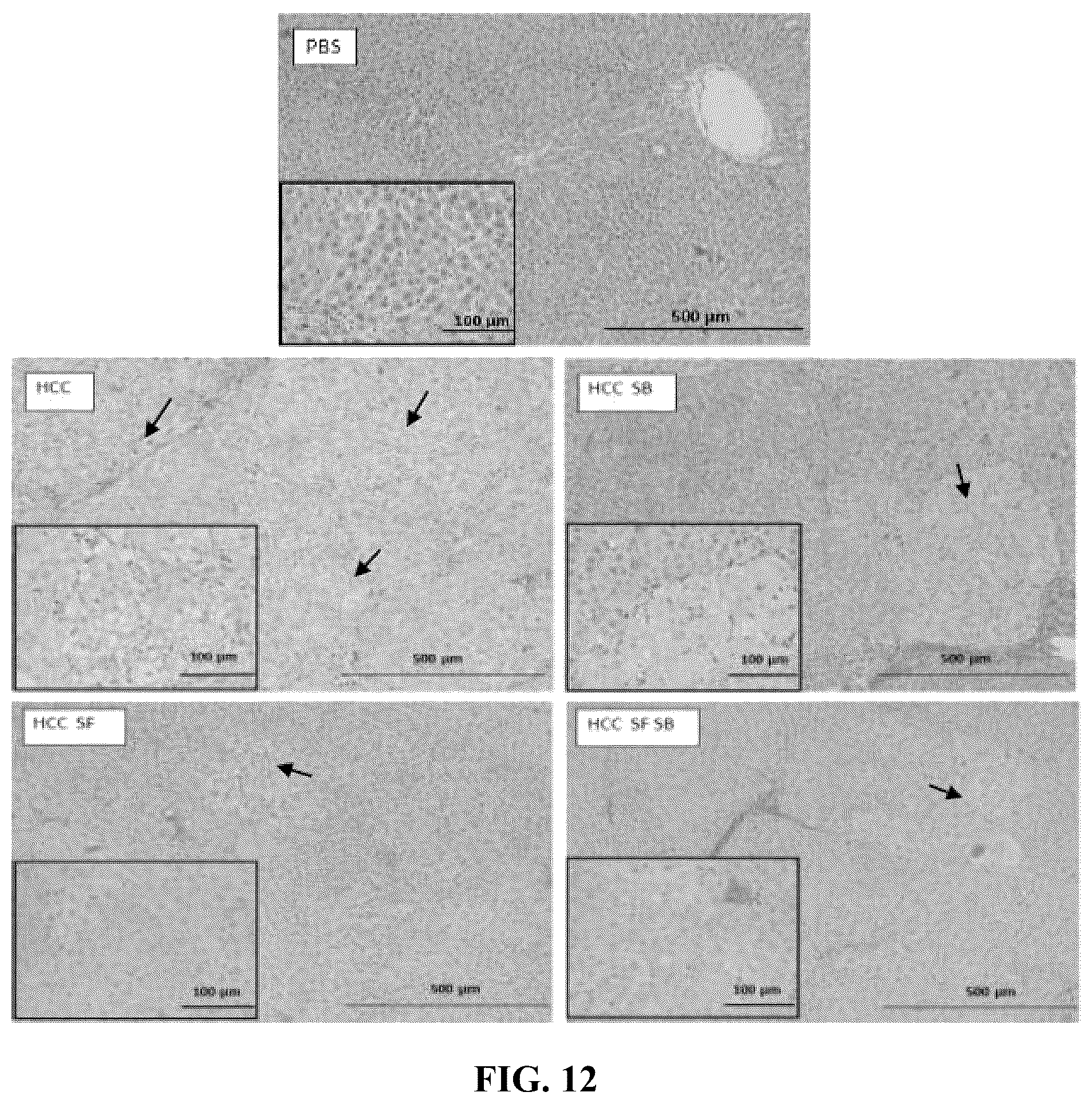 Patent US12576122 Figure 19 – Combination therapy for cancer