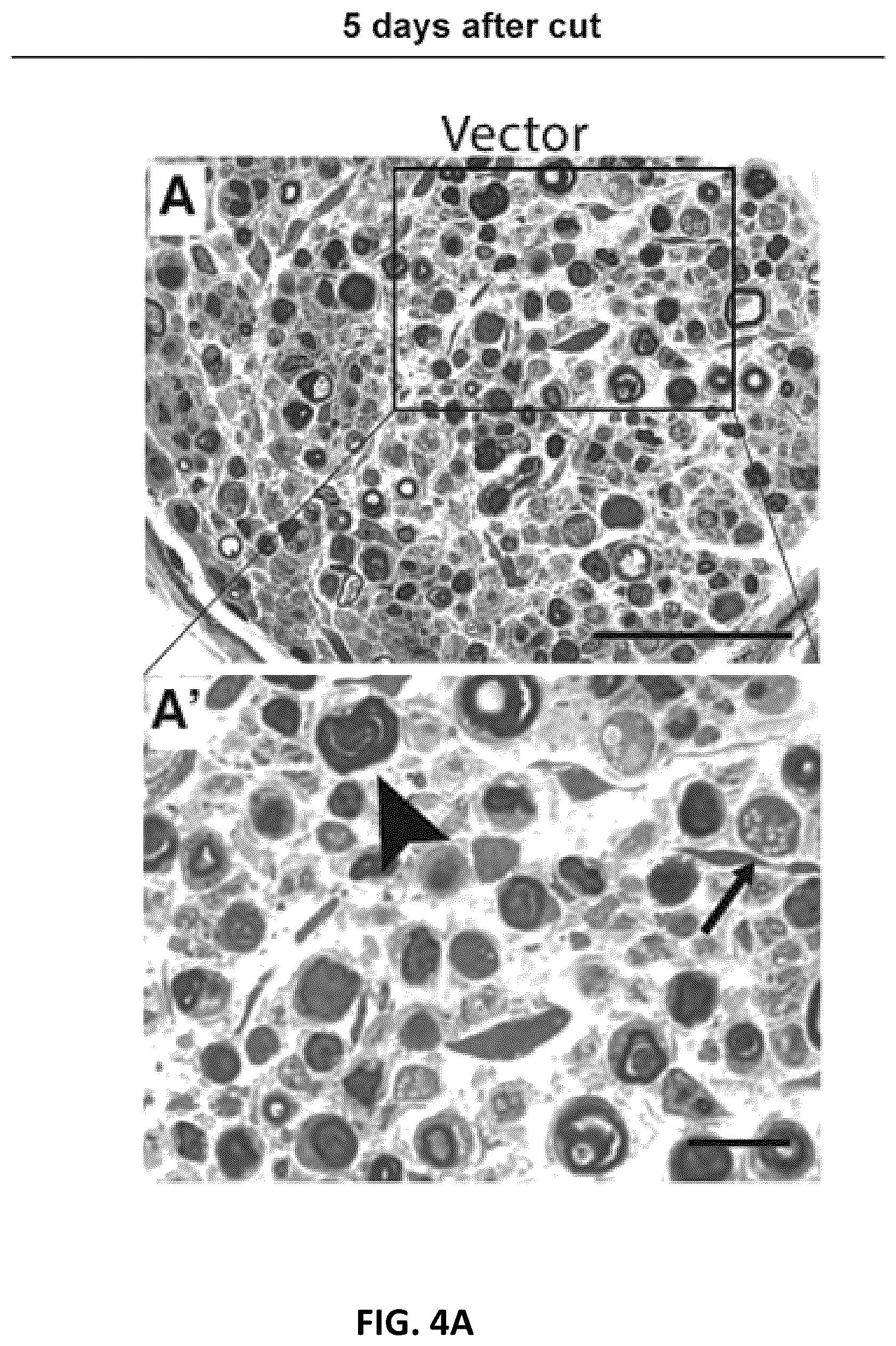 Patent US12576130 Figure 11 – Dominant negative SARM1 molecules comprising a substitution at position 189, 190, 193, 194, 570 and/or 685 of SARM1