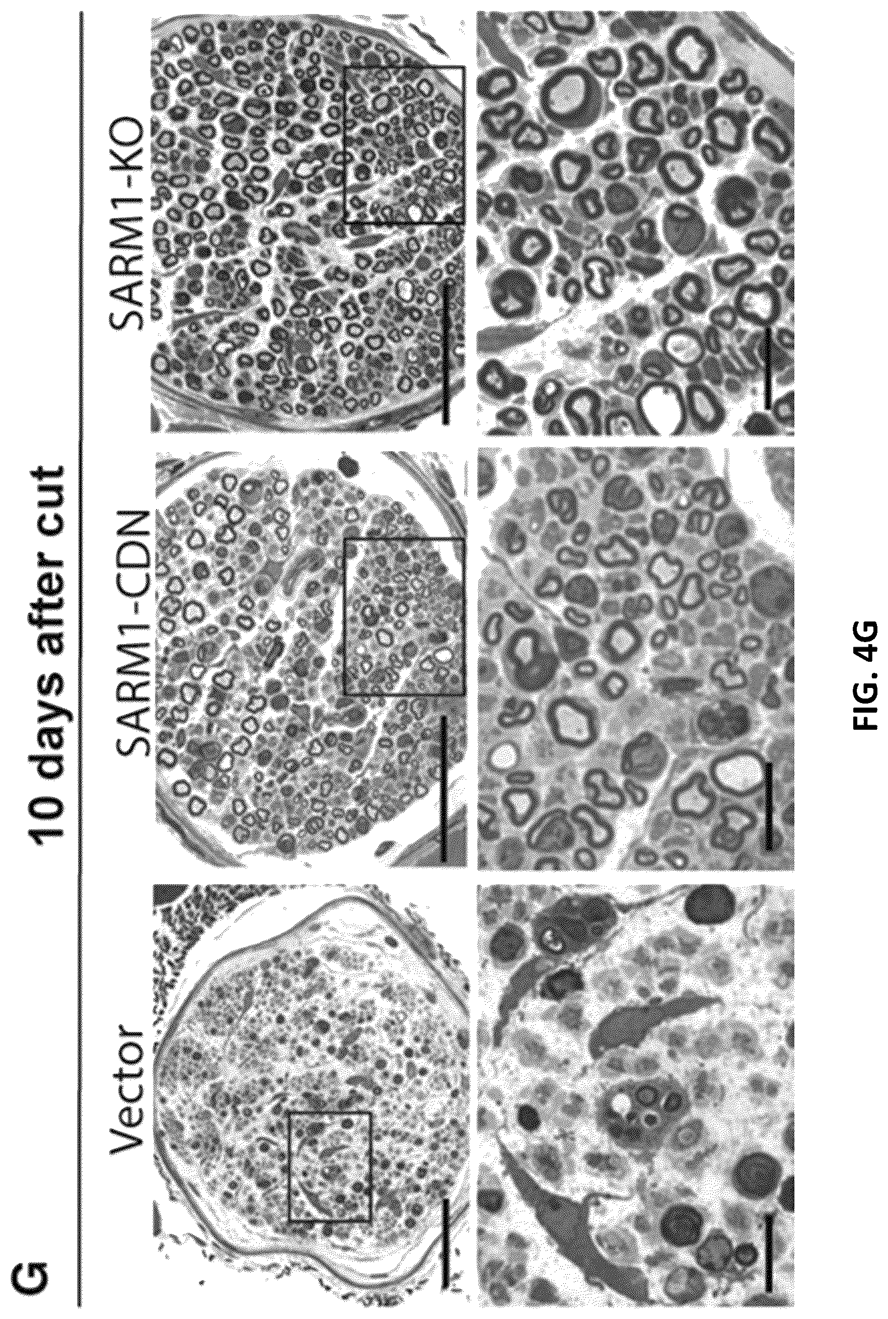 Patent US12576130 Figure 15 – Dominant negative SARM1 molecules comprising a substitution at position 189, 190, 193, 194, 570 and/or 685 of SARM1