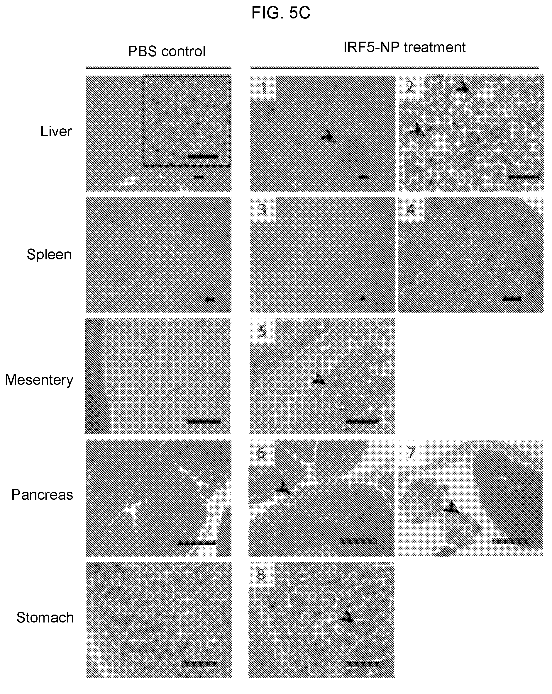 Patent US12576131 Figure 17 – Altering inflammatory states of immune cells in vivo by modulating cellular activation states