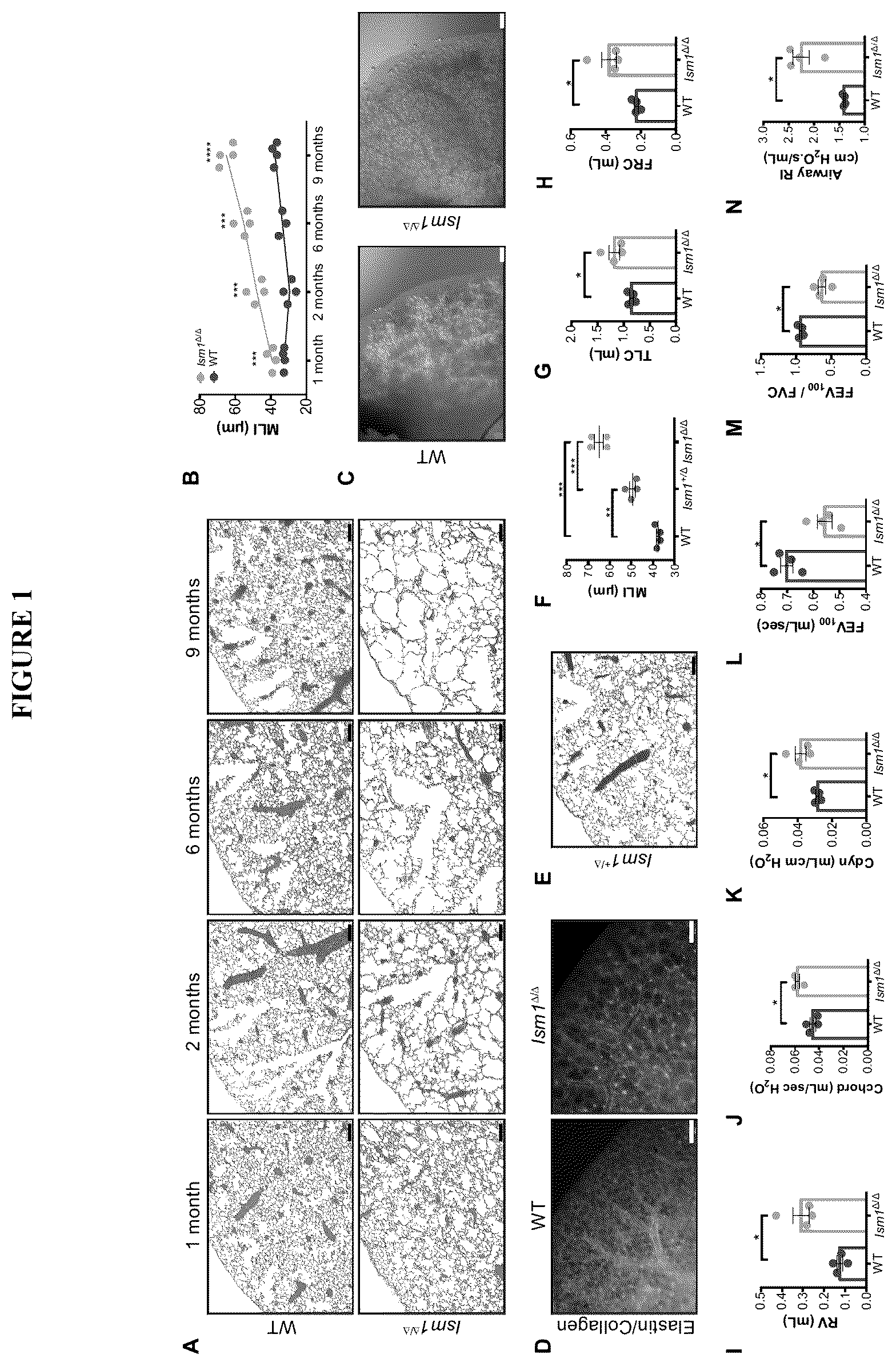 Patent US12576132 Figure 1 – Isthmin 1 for treatment of lung inflammation