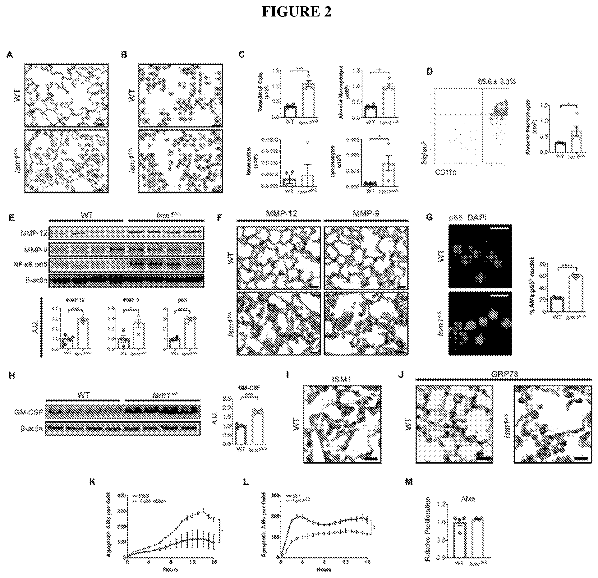 Patent US12576132 Figure 2 – Isthmin 1 for treatment of lung inflammation
