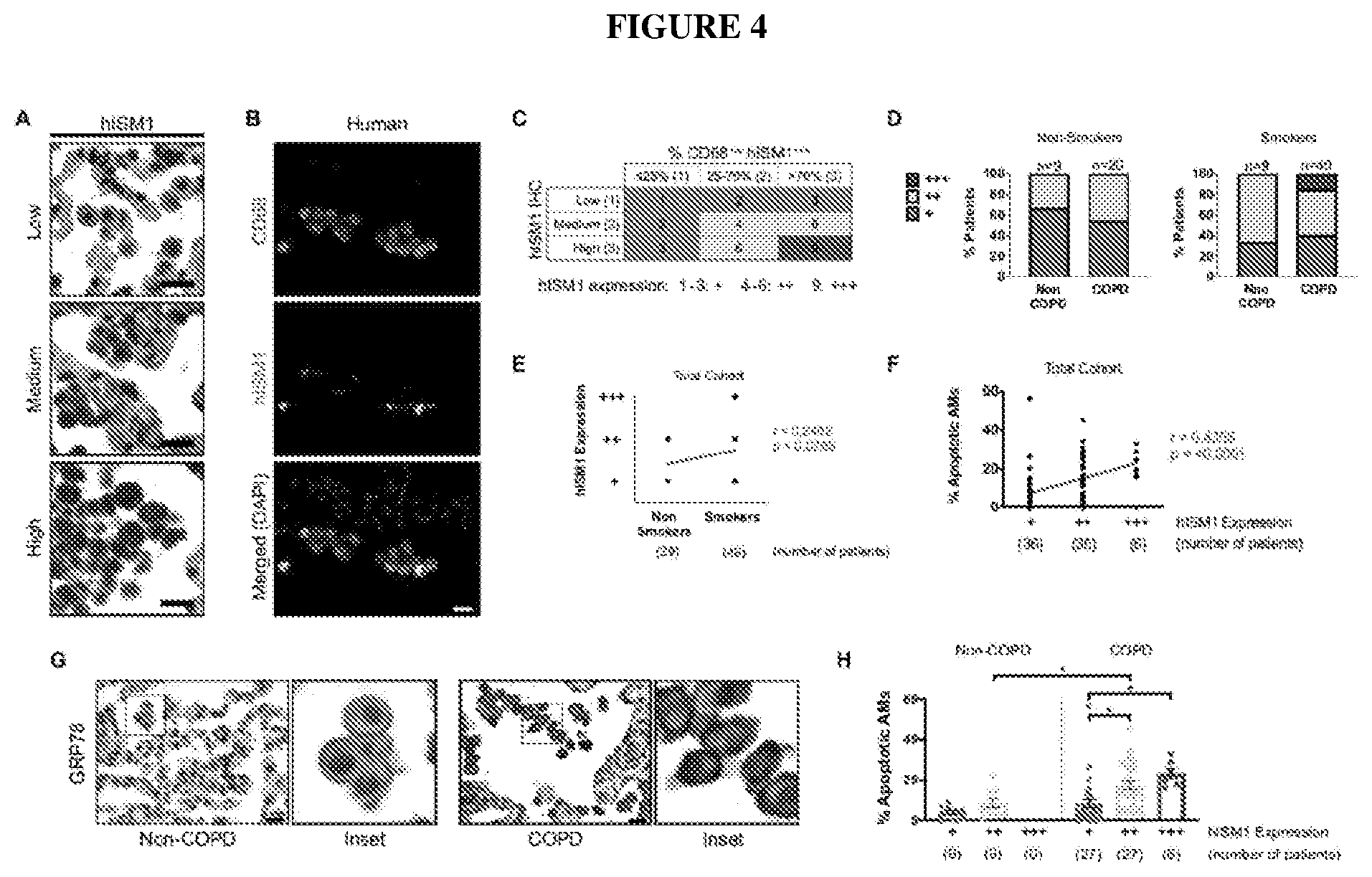 Patent US12576132 Figure 4 – Isthmin 1 for treatment of lung inflammation