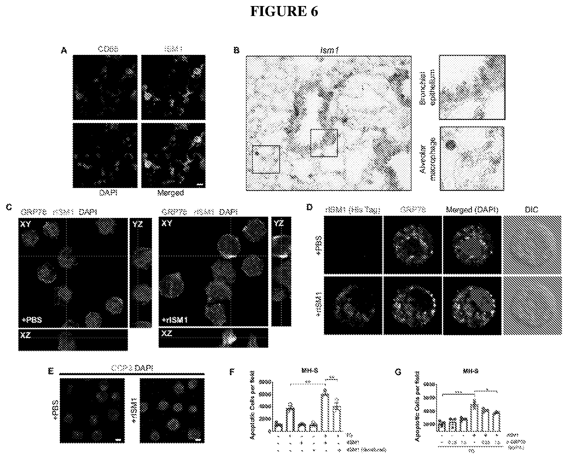 Patent US12576132 Figure 6 – Isthmin 1 for treatment of lung inflammation