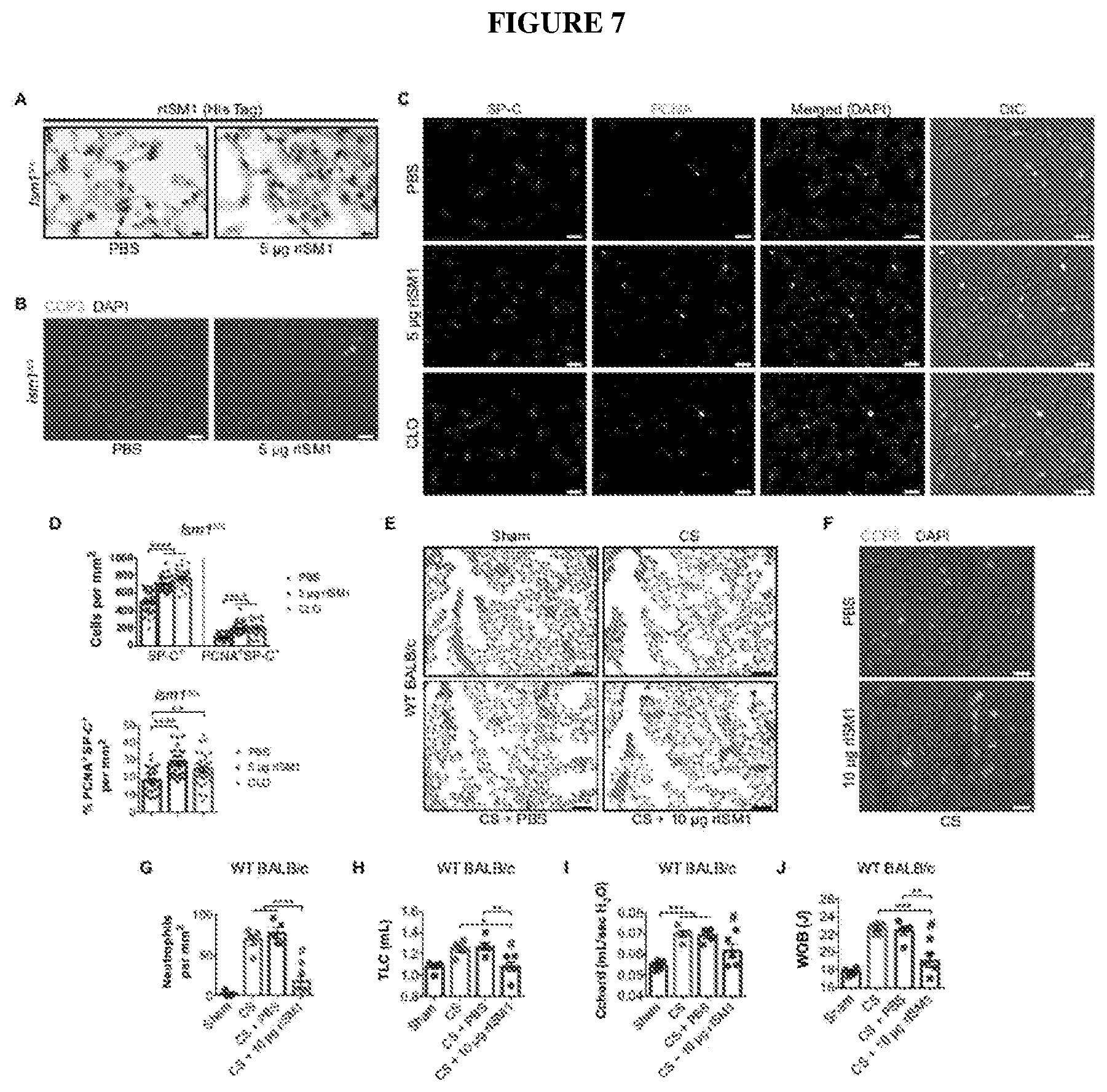 Patent US12576132 Figure 7 – Isthmin 1 for treatment of lung inflammation