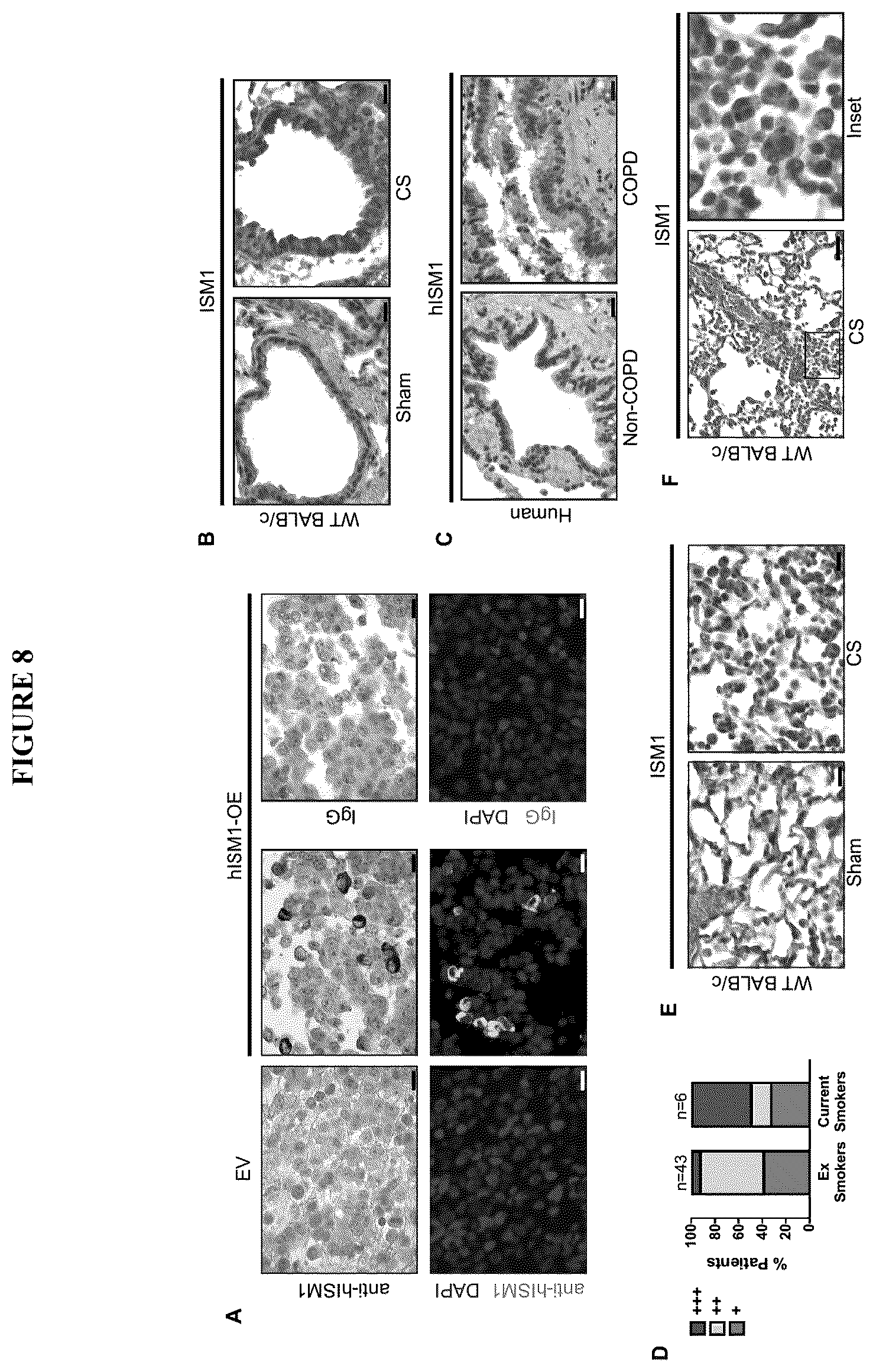 Patent US12576132 Figure 8 – Isthmin 1 for treatment of lung inflammation