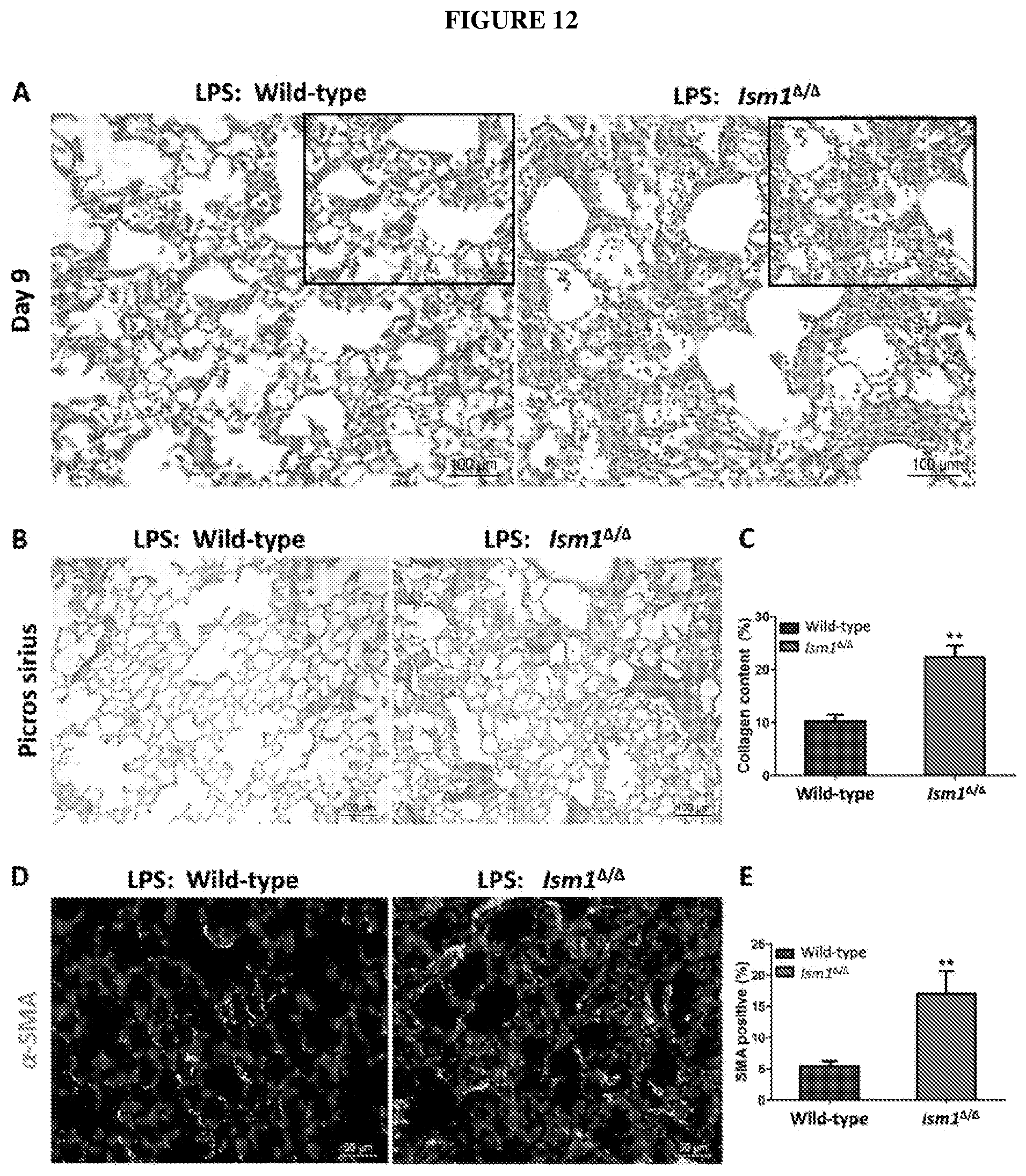 Patent US12576132 Figure 12 – Isthmin 1 for treatment of lung inflammation