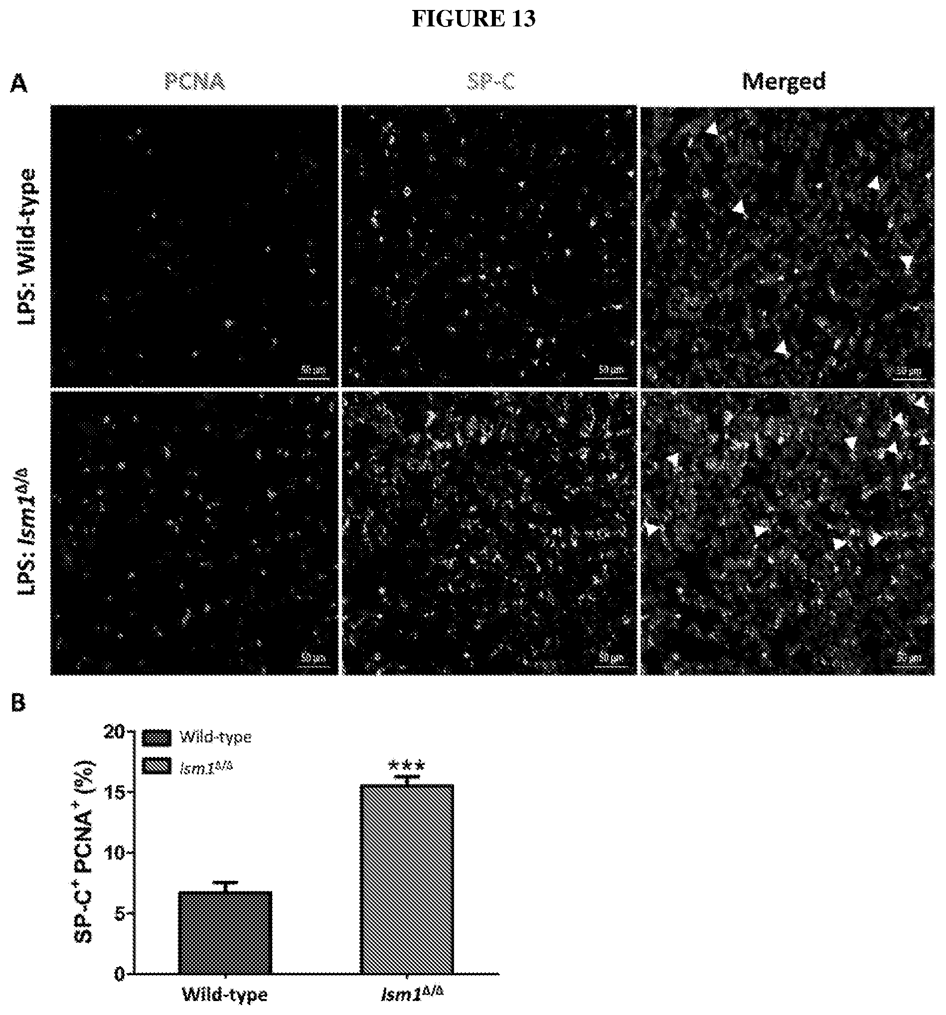 Patent US12576132 Figure 13 – Isthmin 1 for treatment of lung inflammation