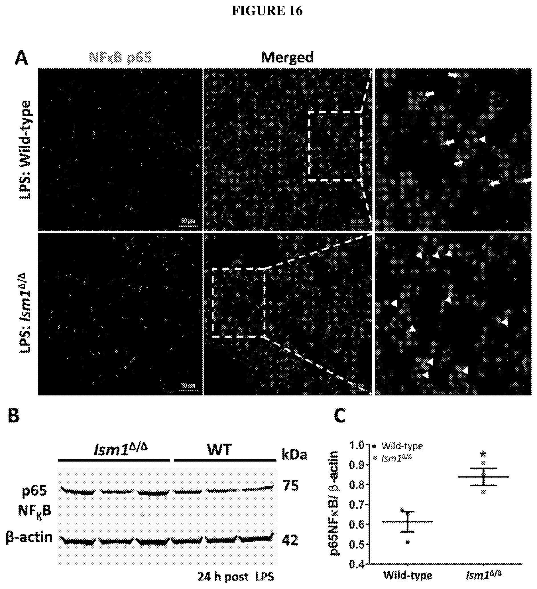 Patent US12576132 Figure 16 – Isthmin 1 for treatment of lung inflammation