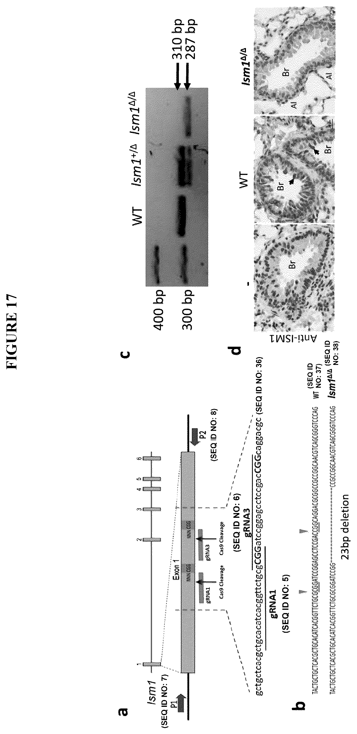 Patent US12576132 Figure 17 – Isthmin 1 for treatment of lung inflammation