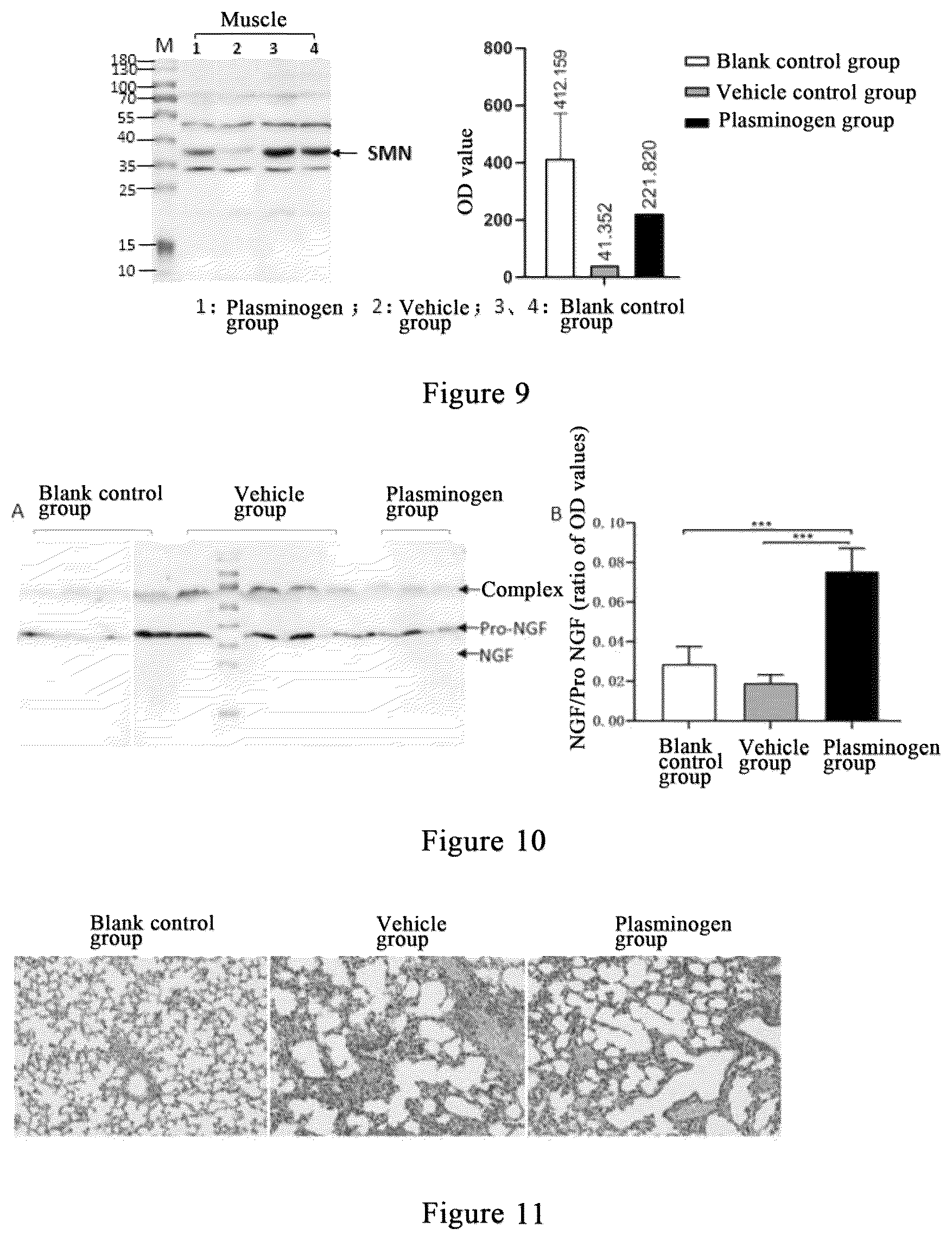 Patent US12576139 Figure 4 – Method and drug for treating spinal muscular atrophy