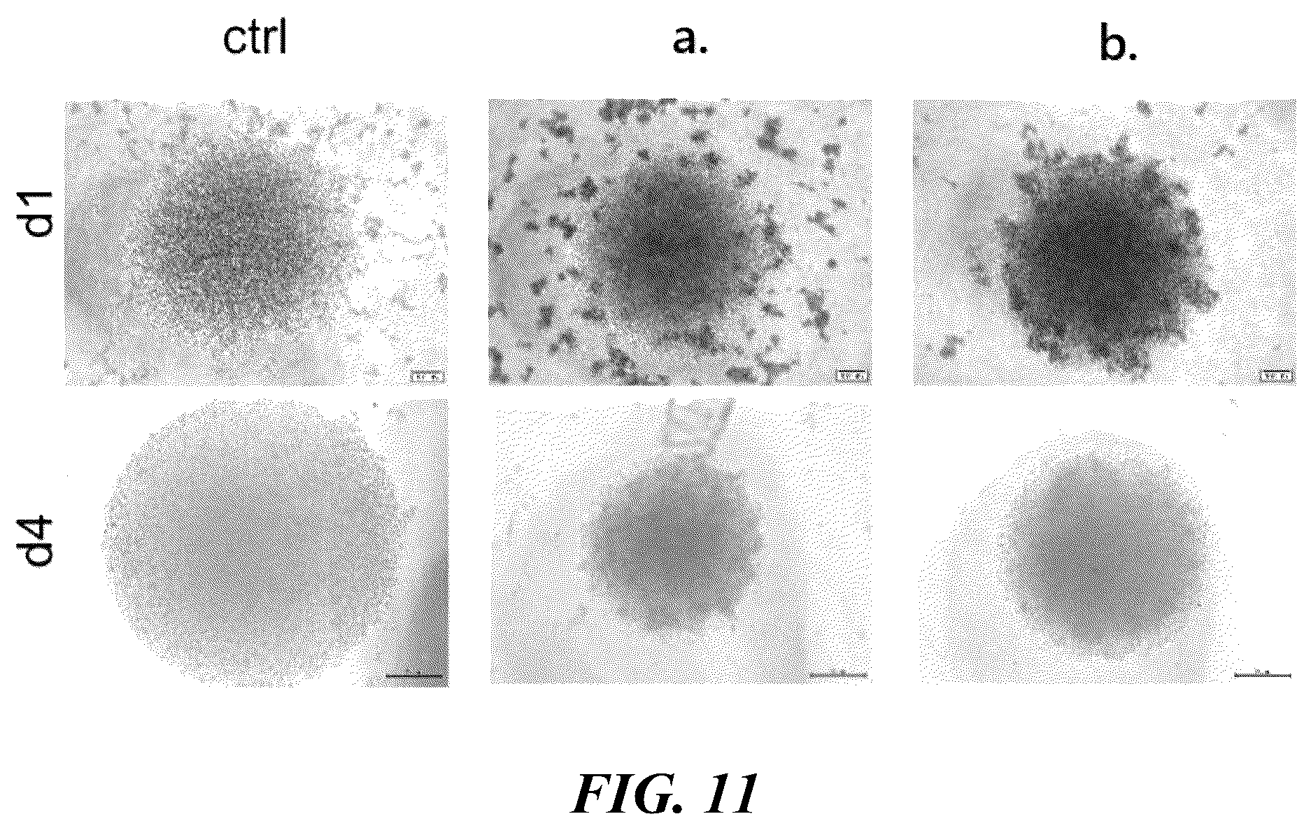 Patent US12576149 Figure 15 – Gamma delta T cells derived from induced pluripotent stem cells, and production method therefor