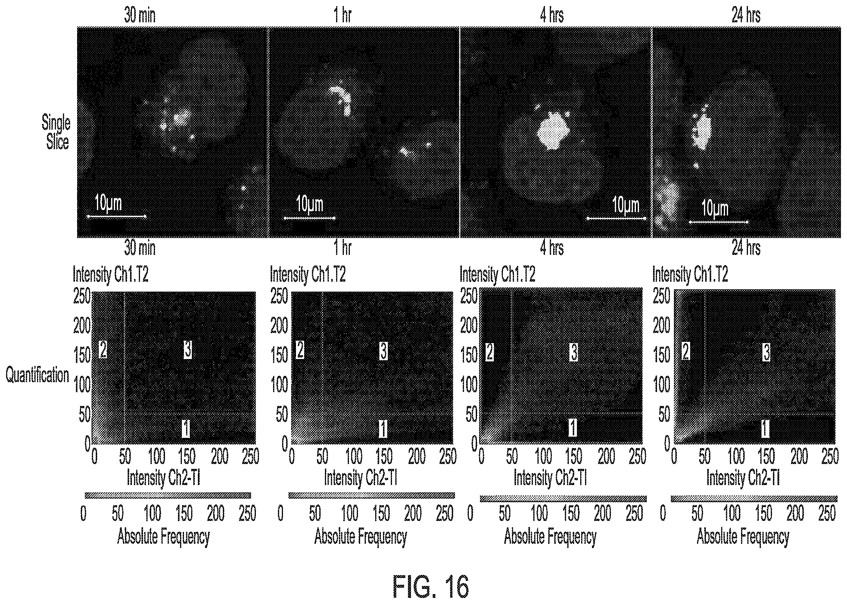 Patent US12576157 Figure 15 – Peptide saporin conjugate for the treatment of cancer
