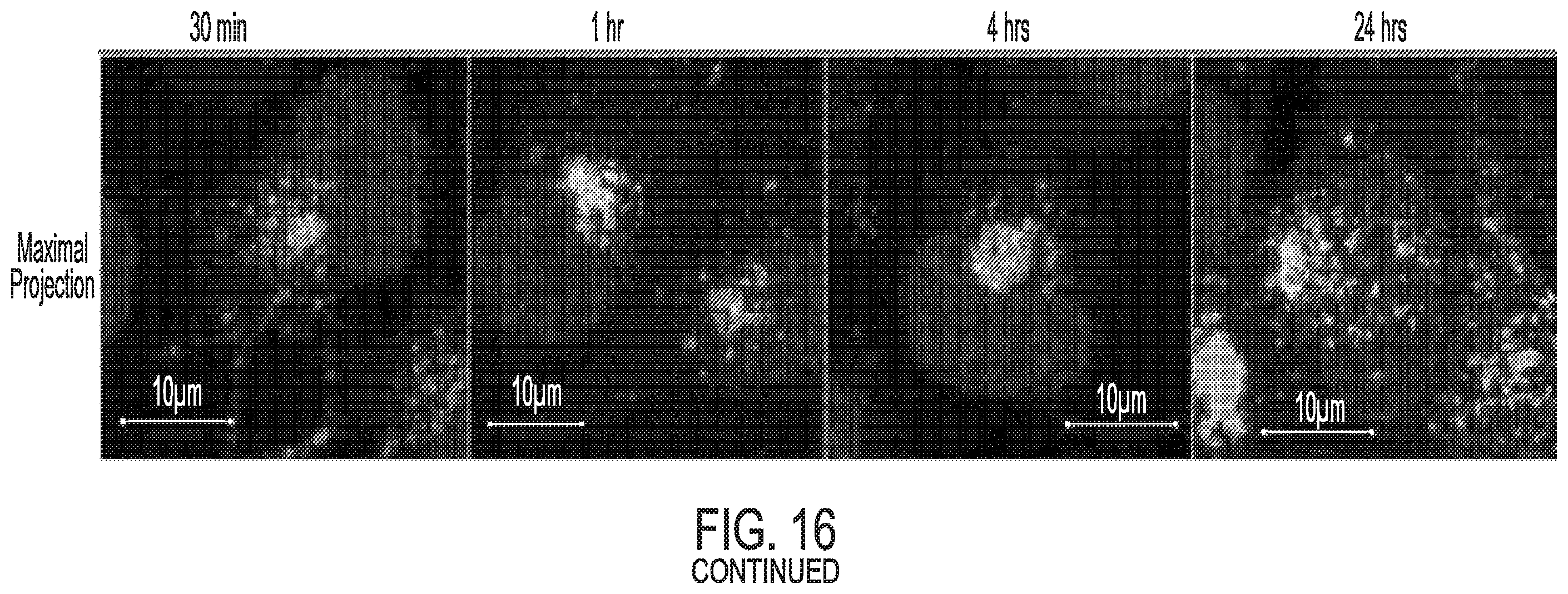 Patent US12576157 Figure 16 – Peptide saporin conjugate for the treatment of cancer