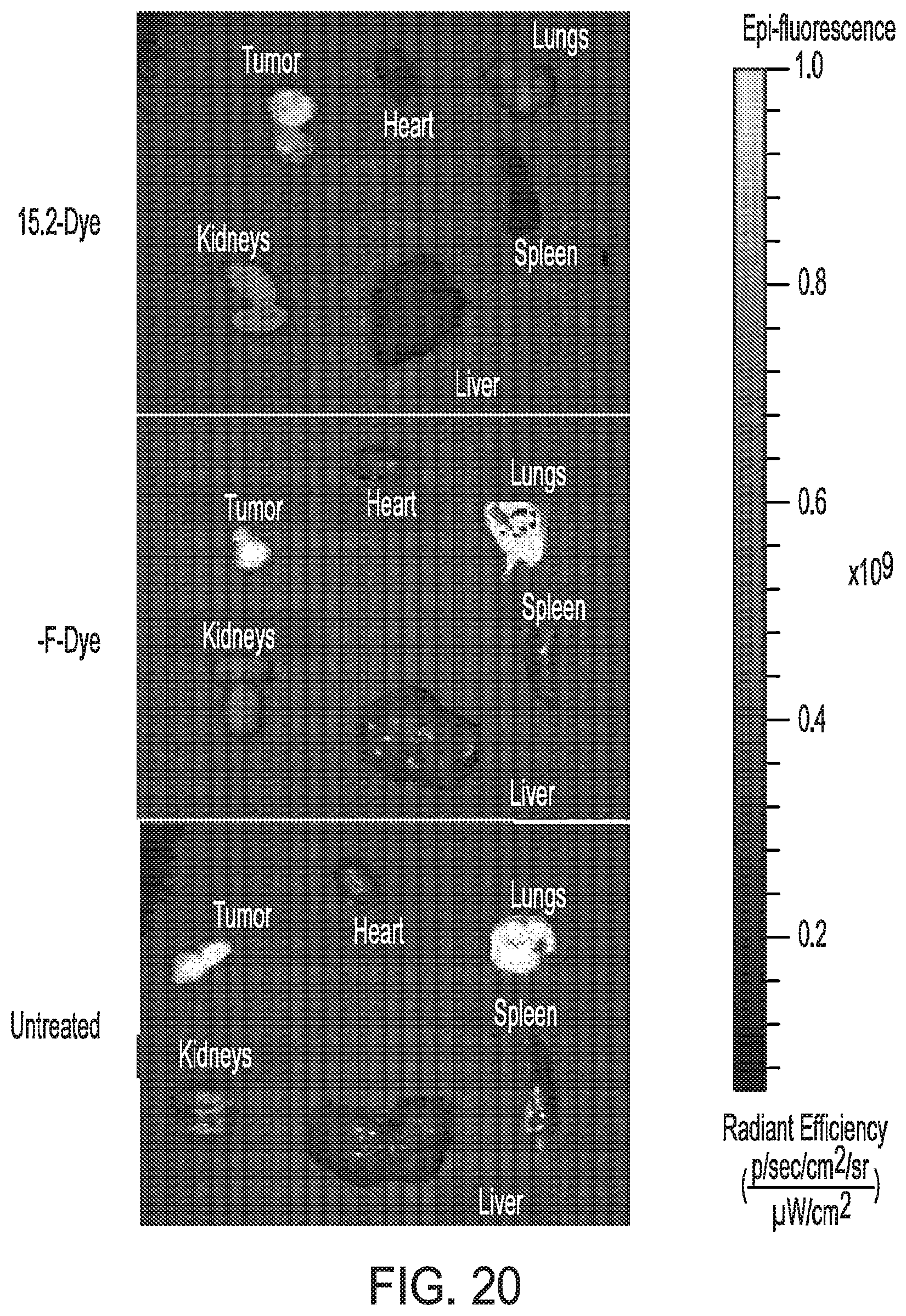 Patent US12576157 Figure 20 – Peptide saporin conjugate for the treatment of cancer
