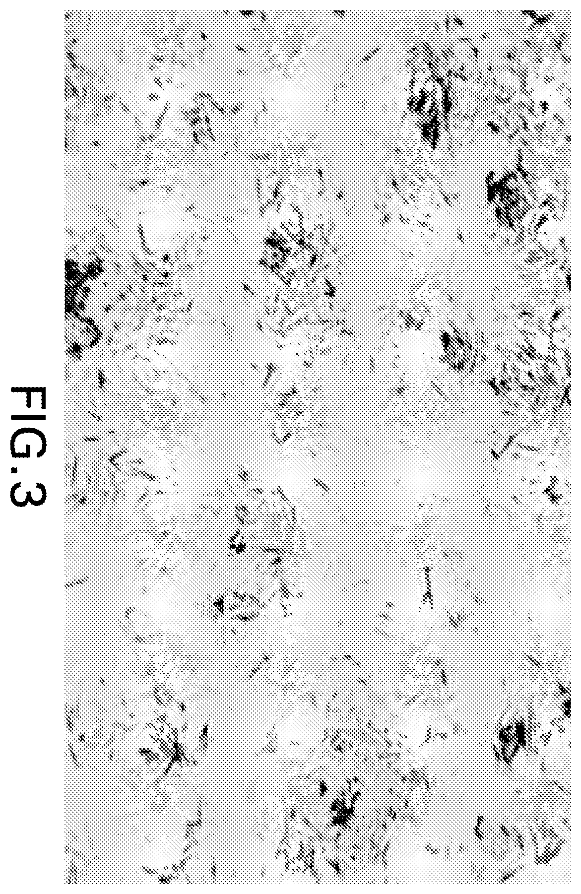 Patent US12576159 Figure 3 – Anti-human PD-1 antibody crystals and methods of use thereof