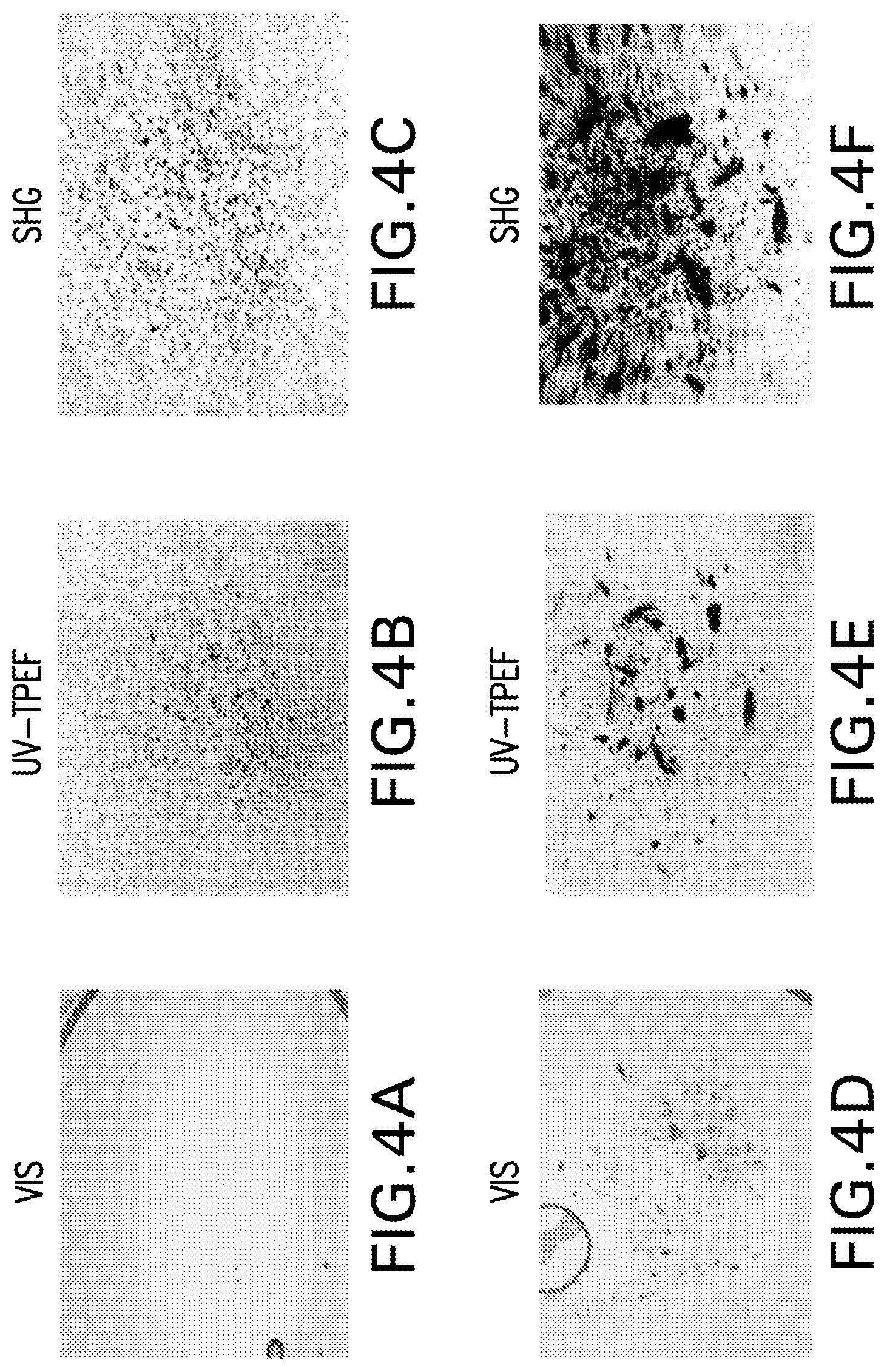 Patent US12576159 Figure 4 – Anti-human PD-1 antibody crystals and methods of use thereof