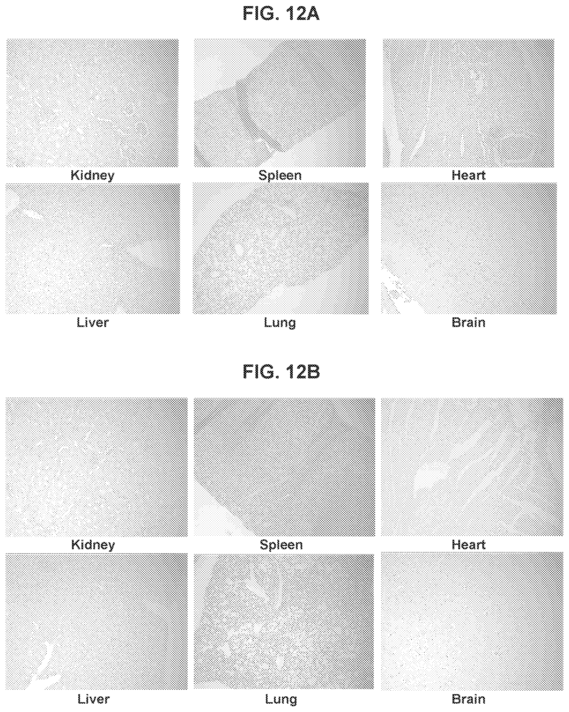 Patent US12576160 Figure 17 – Bispecific nanoparticle systems for targeting cancer cells