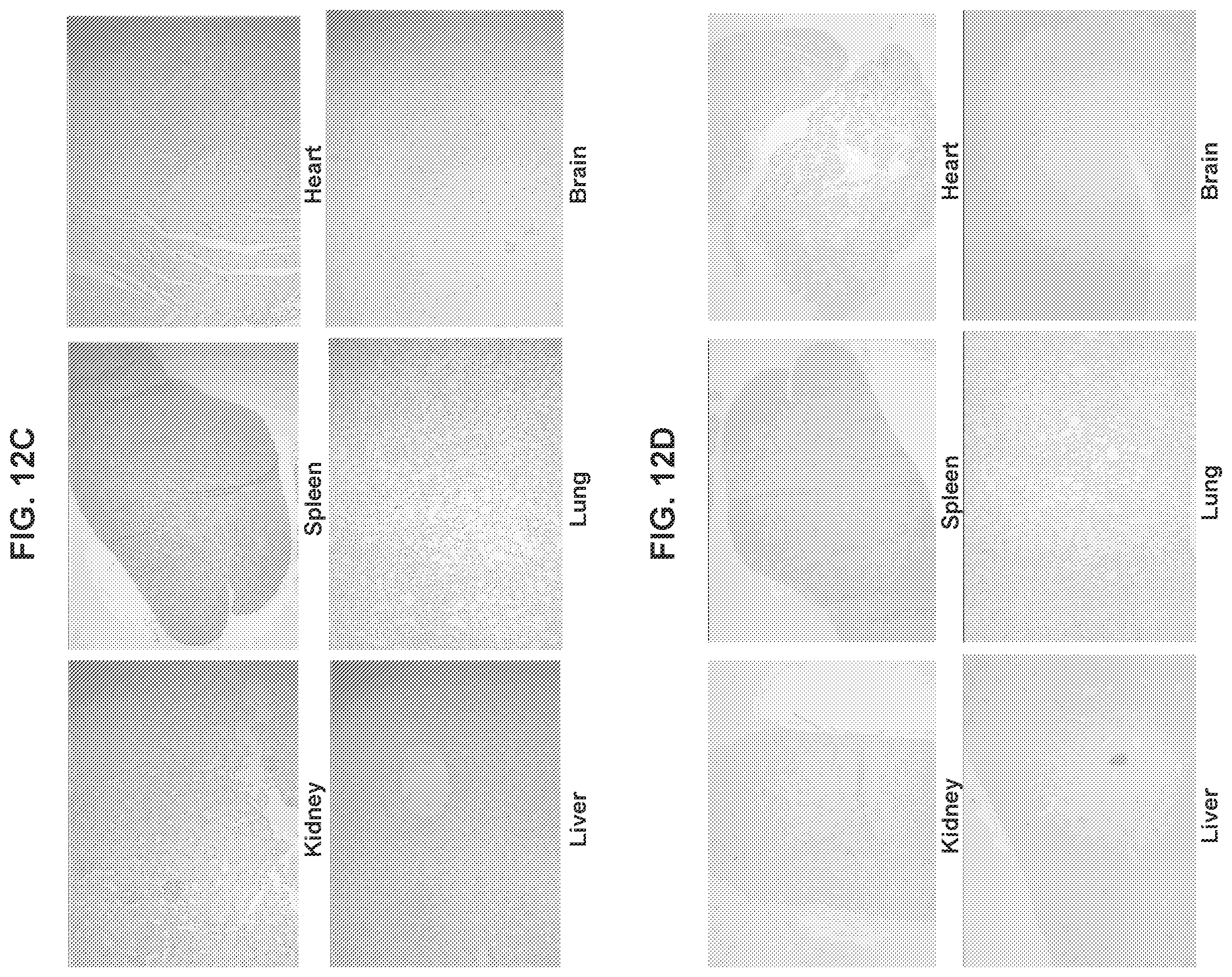 Patent US12576160 Figure 18 – Bispecific nanoparticle systems for targeting cancer cells