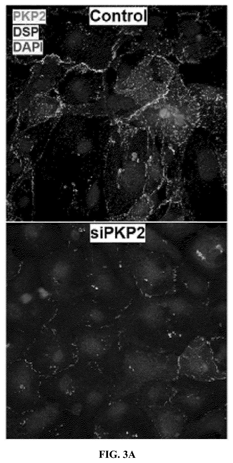 Patent US12576161 Figure 3 – Plakophillin-2 gene therapy methods and compositions