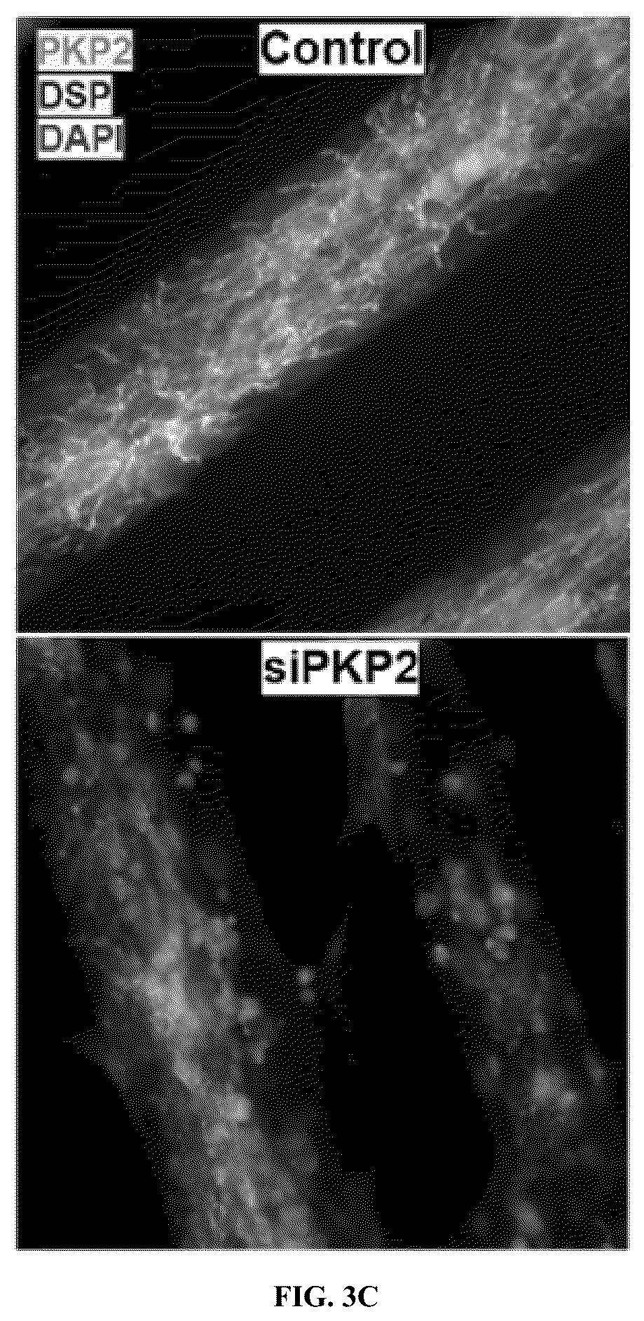 Patent US12576161 Figure 5 – Plakophillin-2 gene therapy methods and compositions