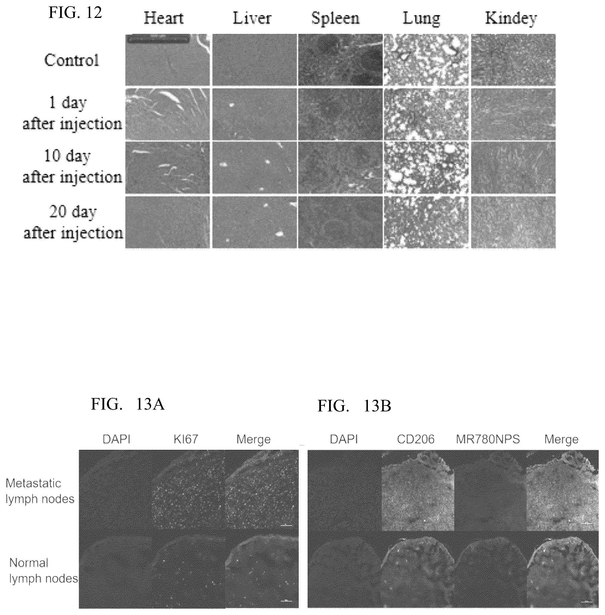 Patent US12576163 Figure 13 – Fluorescent contrast agent with targeting function, and preparation method and use thereof