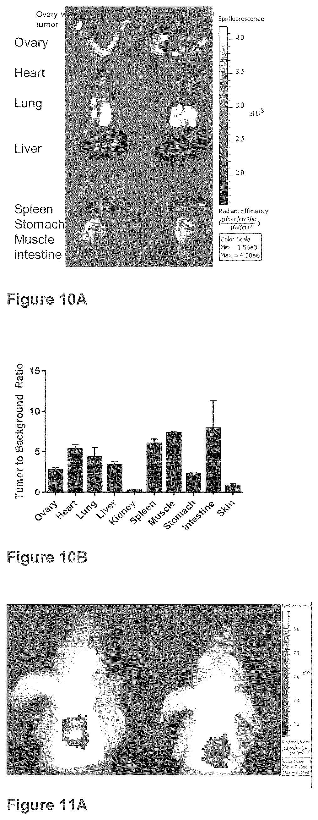 Patent US12576165 Figure 16 – Synthesis and composition of amino acid linking groups conjugated to compounds used for the targeted imaging of tumors