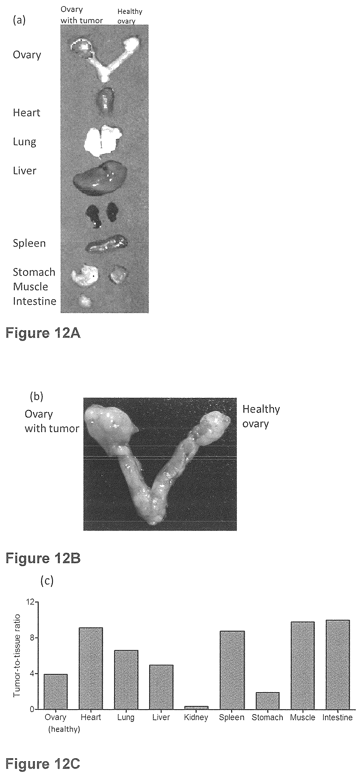 Patent US12576165 Figure 18 – Synthesis and composition of amino acid linking groups conjugated to compounds used for the targeted imaging of tumors