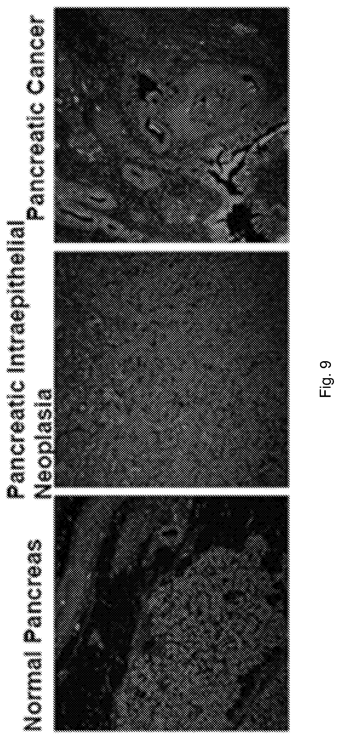 Patent US12576168 Figure 9 – Peptide PET/SPECT probes specific to oncoproteins in tumor extracellular matrix