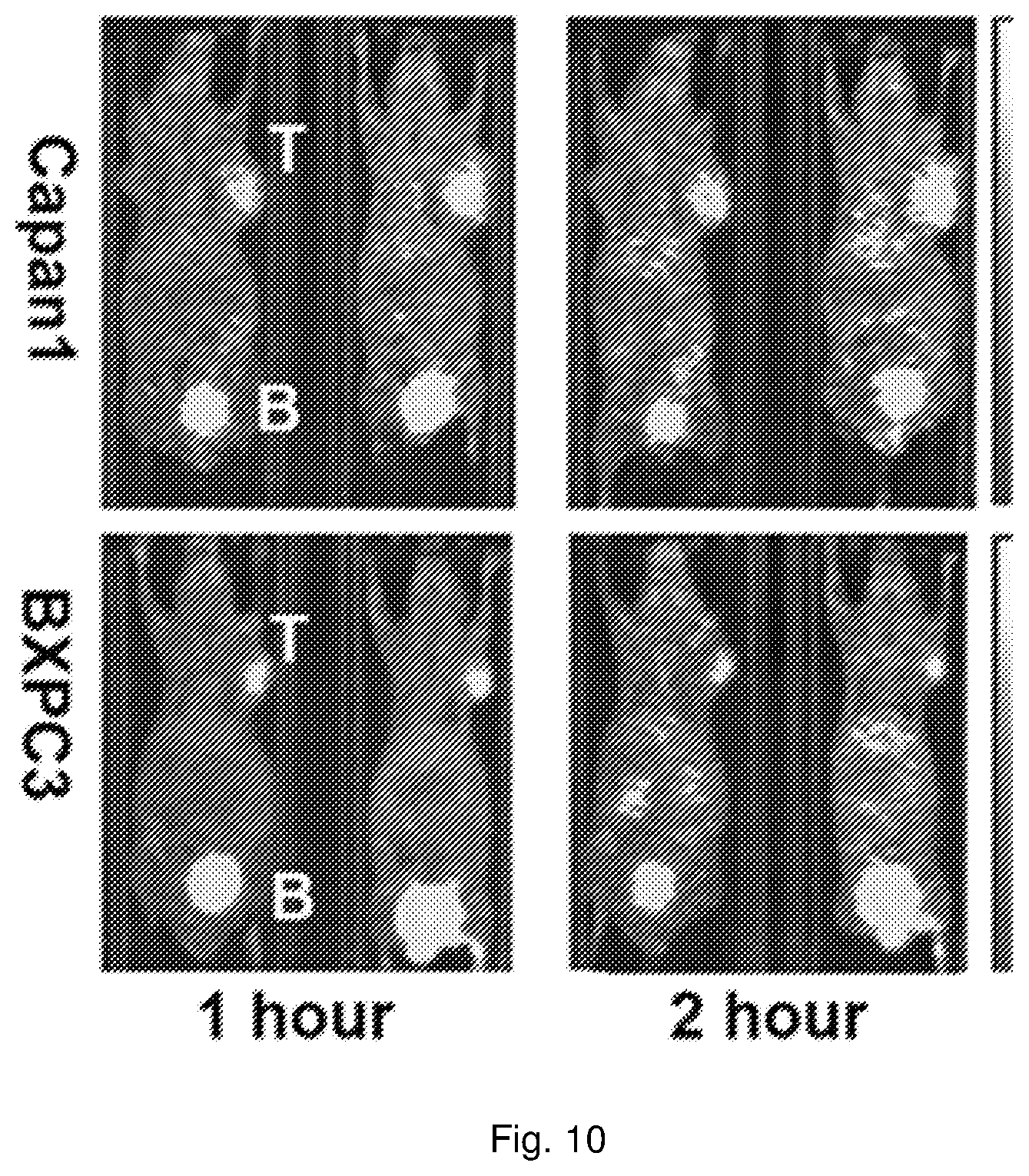 Patent US12576168 Figure 10 – Peptide PET/SPECT probes specific to oncoproteins in tumor extracellular matrix