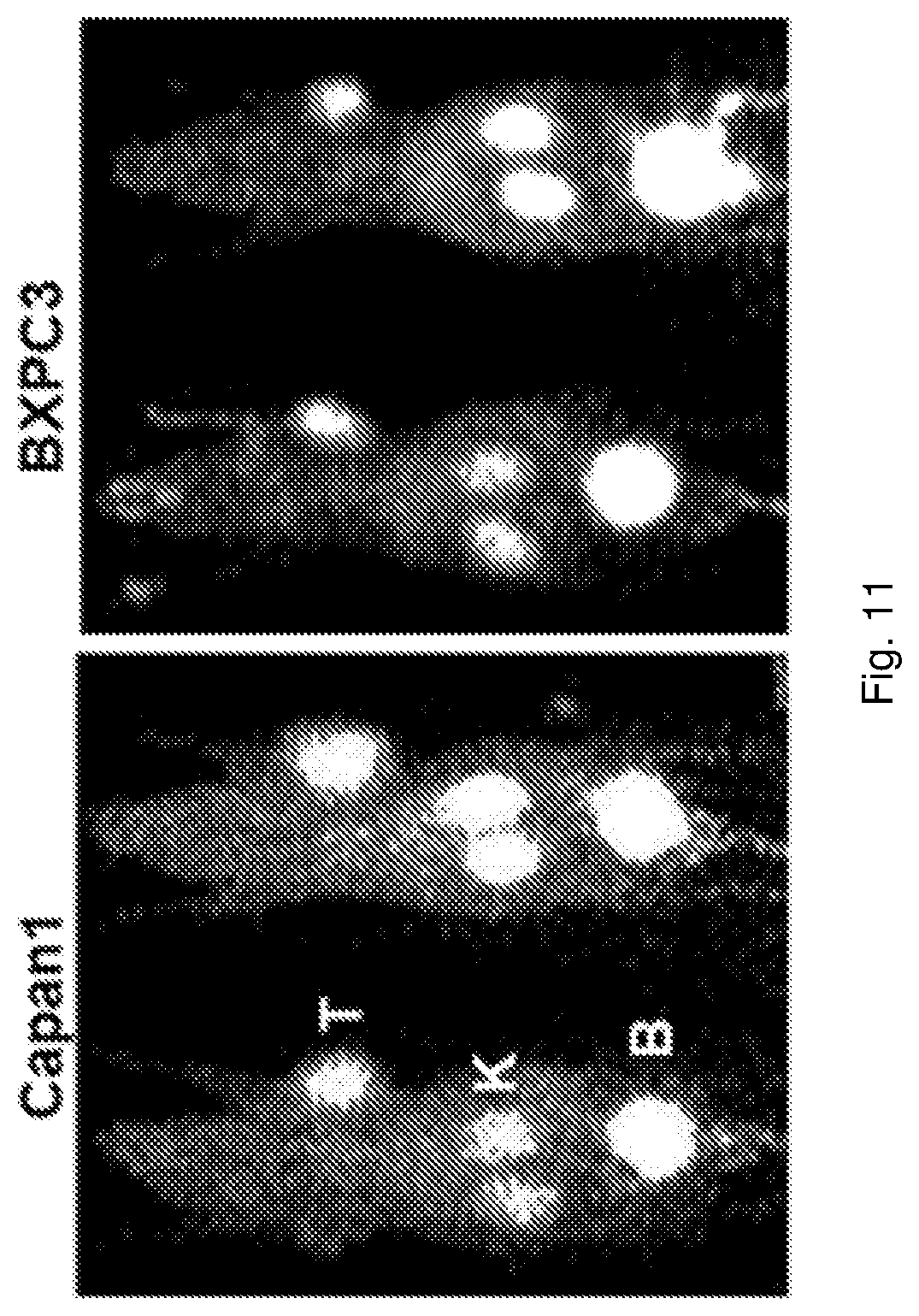 Patent US12576168 Figure 11 – Peptide PET/SPECT probes specific to oncoproteins in tumor extracellular matrix